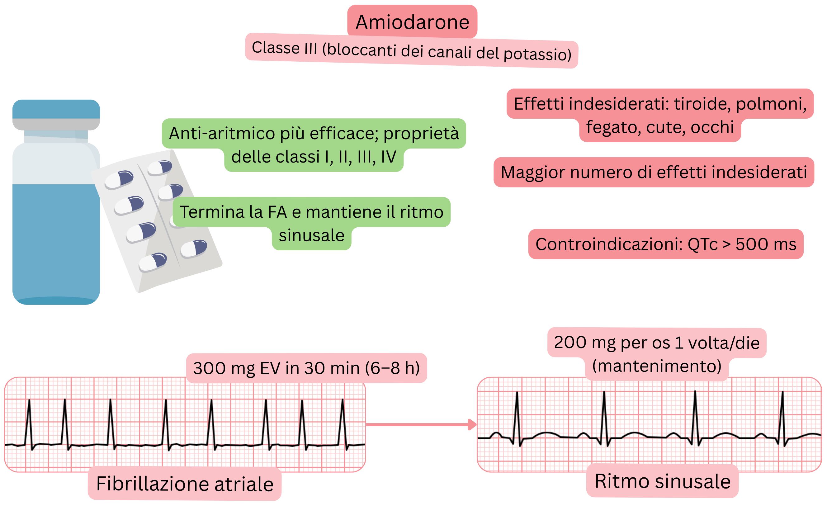Schema dell’effetto dell’amiodarone come antiaritmico di classe III con azione multicanale che illustra la cardioversione farmacologica della fibrillazione atriale e il mantenimento del ritmo sinusale.