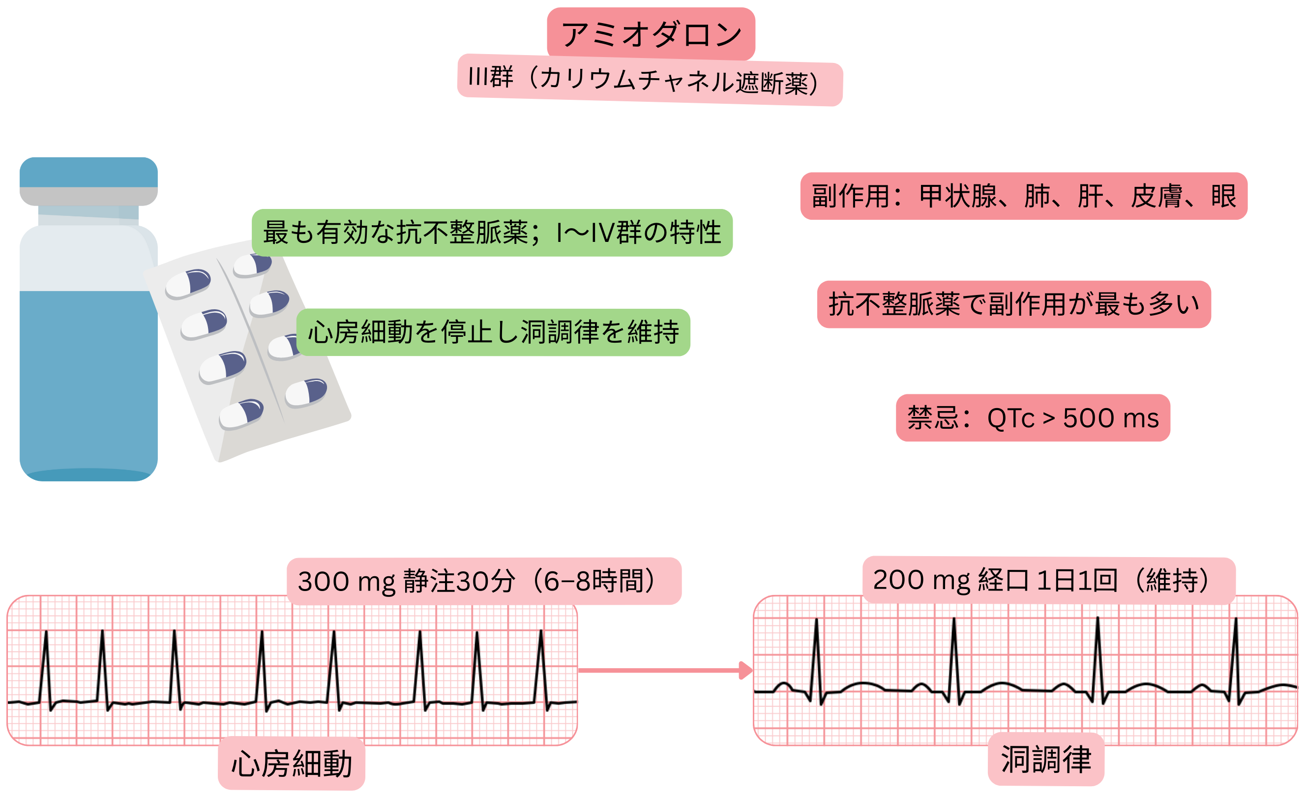 多チャネル作用を有するIII群抗不整脈薬としてのアミオダロンの作用を示す模式図で、心房細動の薬物的洞調律化と洞調律維持を示す。
