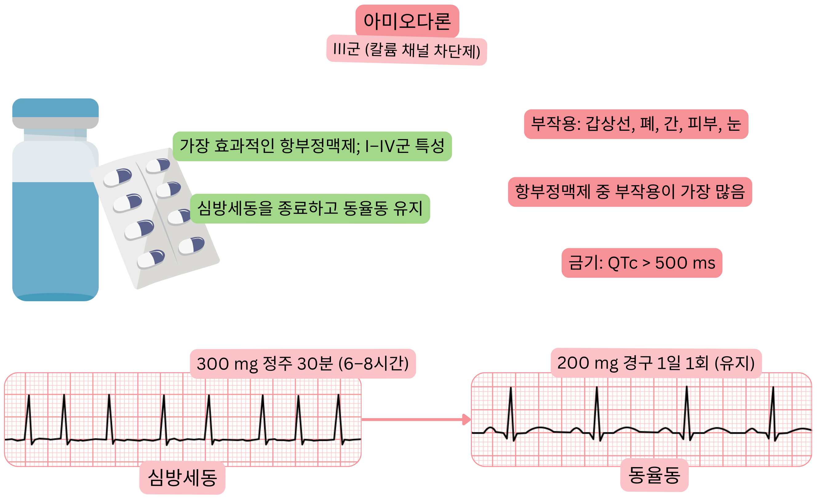 다중 채널 작용을 가진 III군 항부정맥제로서 아미오다론의 효과를 나타낸 도식으로, 심방세동의 약물적 동율동 전환과 동율동 유지를 보여준다.