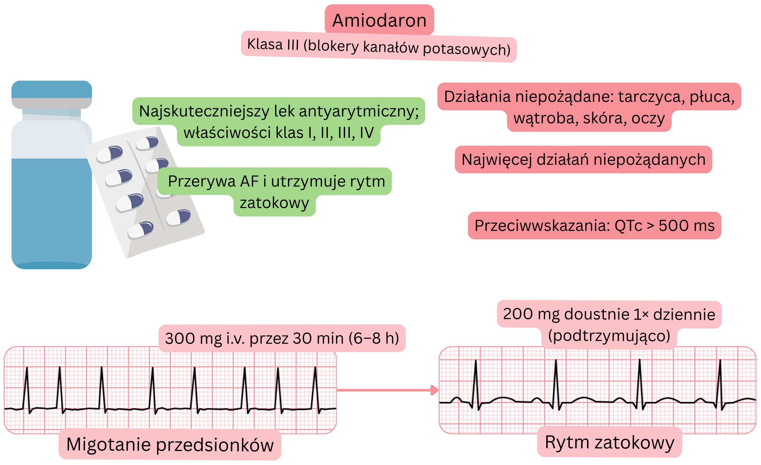 Schemat działania amiodaronu jako leku antyarytmicznego klasy III o wielokanałowym mechanizmie, przedstawiający farmakologiczną kardiowersję migotania przedsionków oraz utrzymanie rytmu zatokowego.