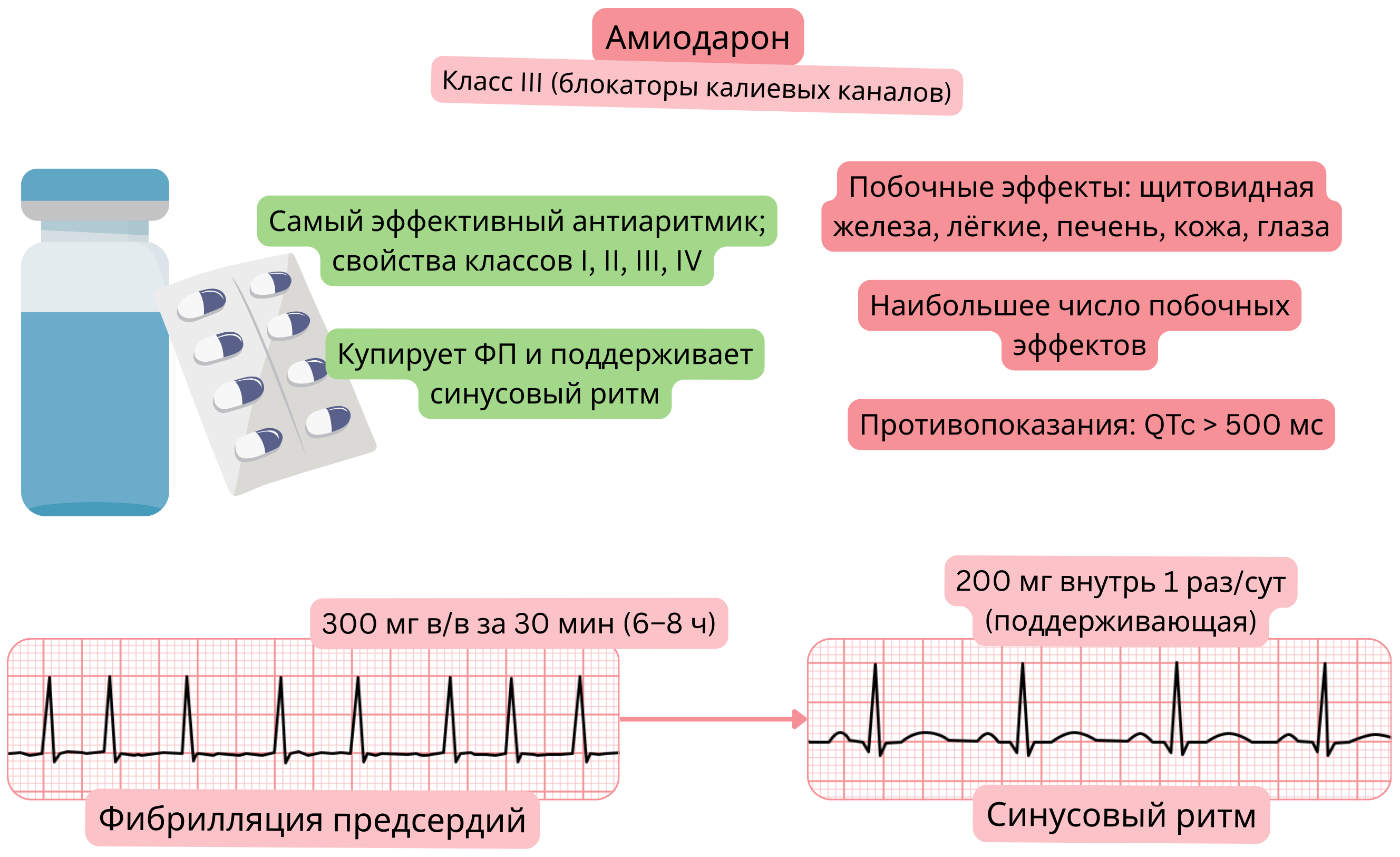 Схема действия амиодарона как антиаритмического препарата класса III с мультиканальным эффектом, демонстрирующая фармакологическую кардиоверсию фибрилляции предсердий и поддержание синусового ритма.