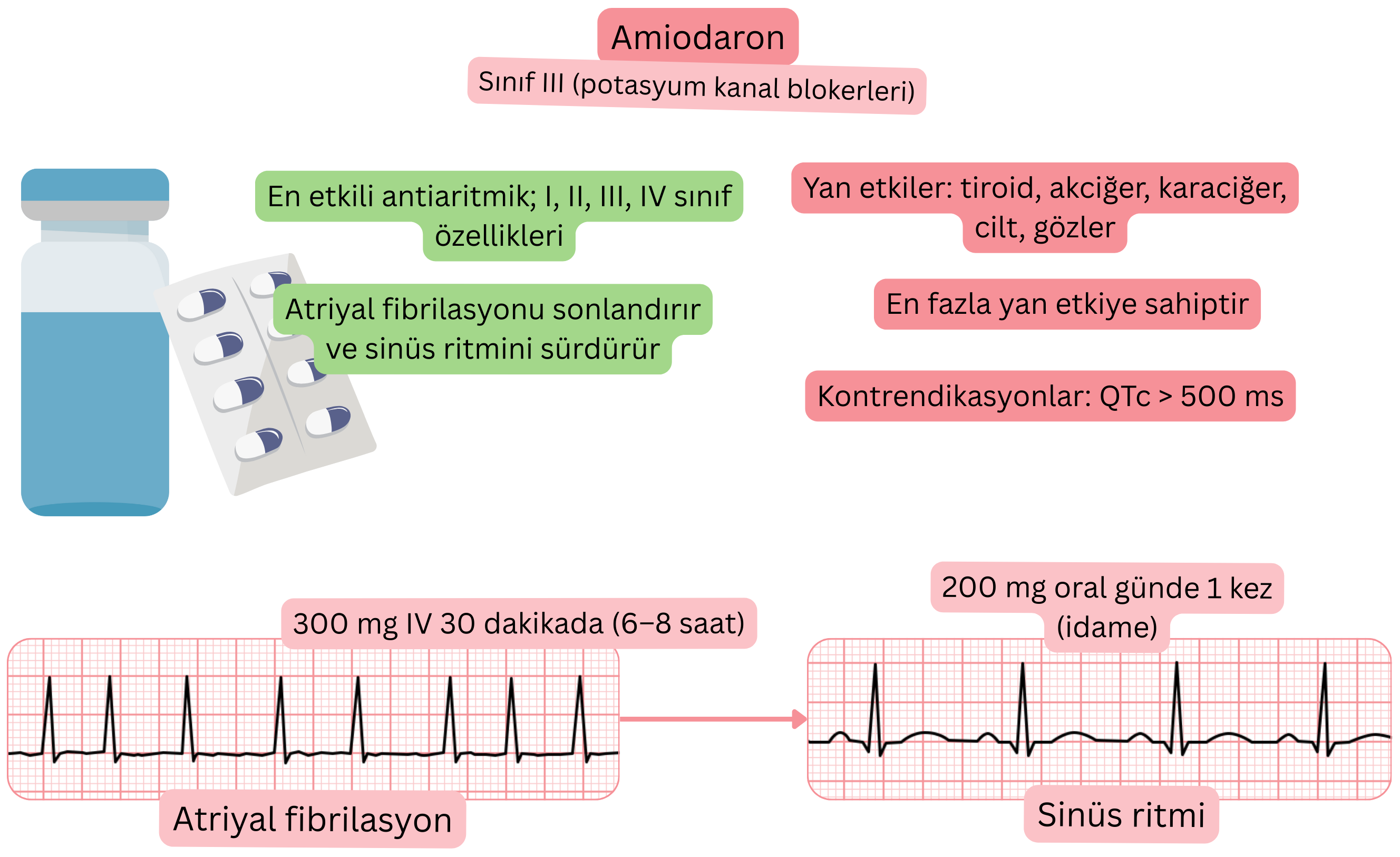 Çok kanallı etkiye sahip III sınıfı antiaritmik olarak amiodaronun etkisini gösteren şema; atriyal fibrilasyonun farmakolojik kardiyoversiyonunu ve sinüs ritminin sürdürülmesini göstermektedir.