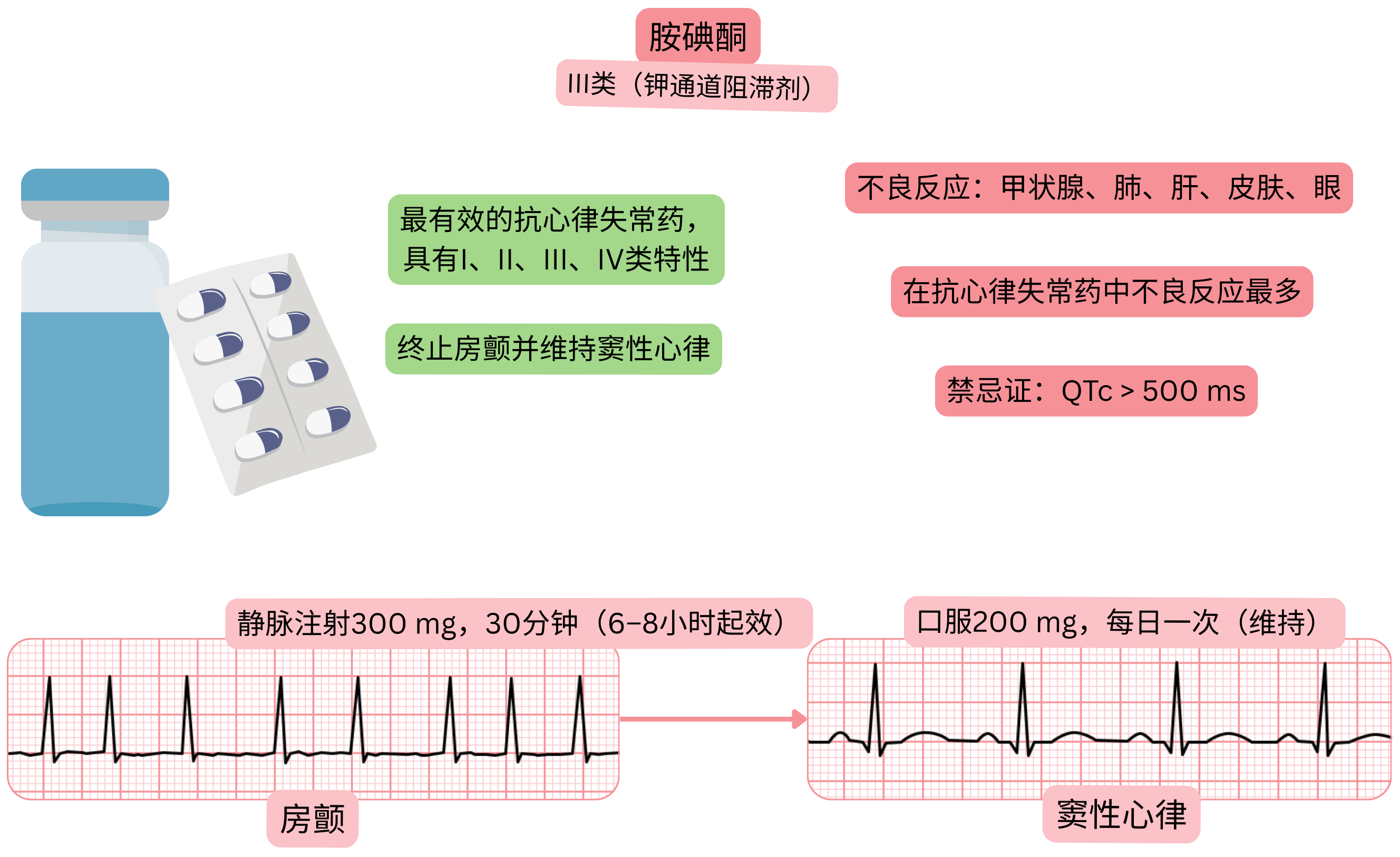 胺碘酮作为具有多通道作用的III类抗心律失常药物的作用示意图，显示心房颤动的药物复律及窦性心律的维持。