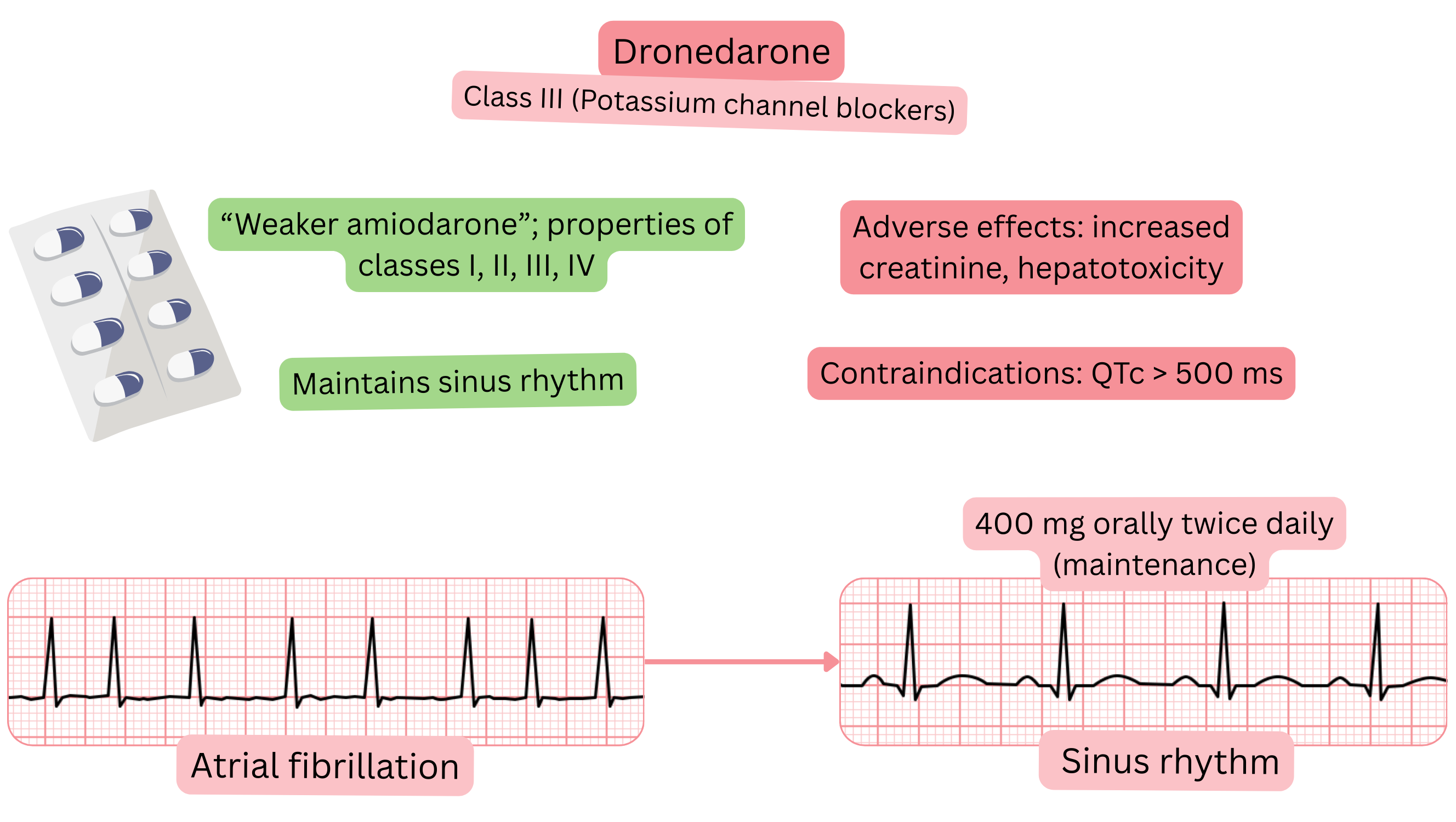 Diagram of the effect of dronedarone as a class III antiarrhythmic illustrating multichannel action, maintenance of sinus rhythm, and pharmacological treatment of atrial fibrillation.