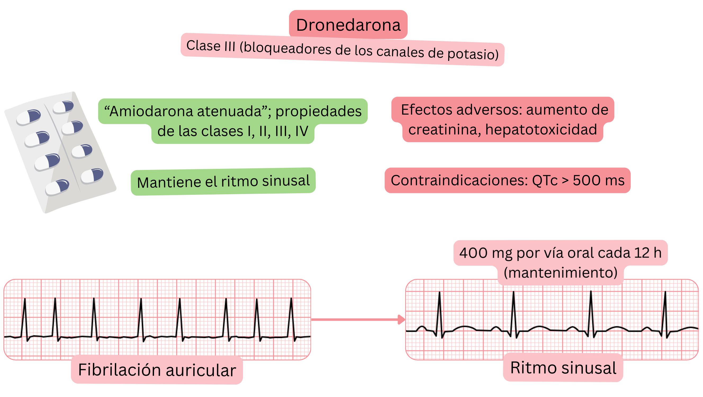 Esquema del efecto de la dronedarona como antiarrítmico de clase III que muestra su acción multicanal, el mantenimiento del ritmo sinusal y el tratamiento farmacológico de la fibrilación auricular.