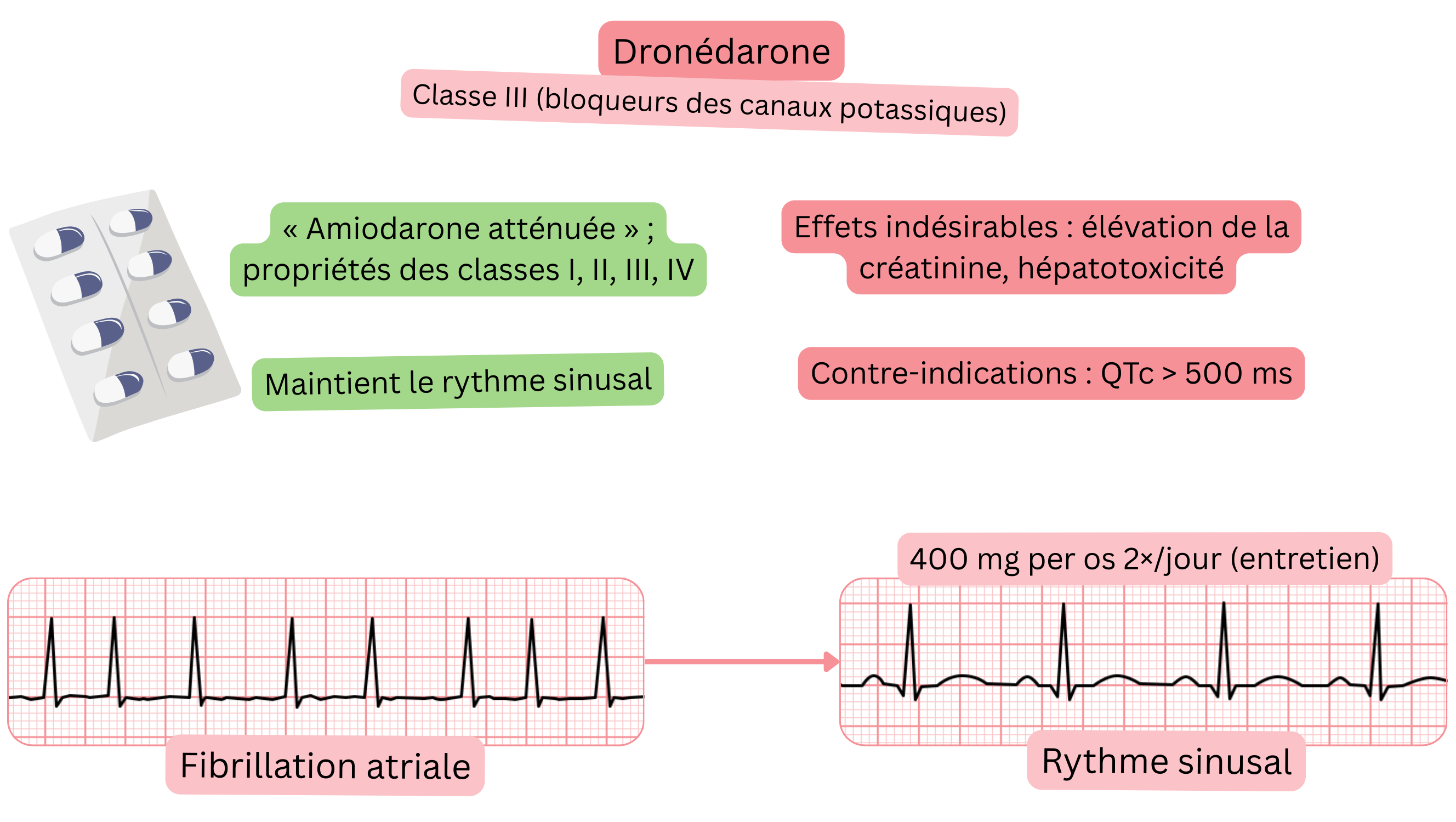 Schéma de l’effet de la dronédarone comme antiarythmique de classe III illustrant une action multicanale, le maintien du rythme sinusal et le traitement pharmacologique de la fibrillation auriculaire.