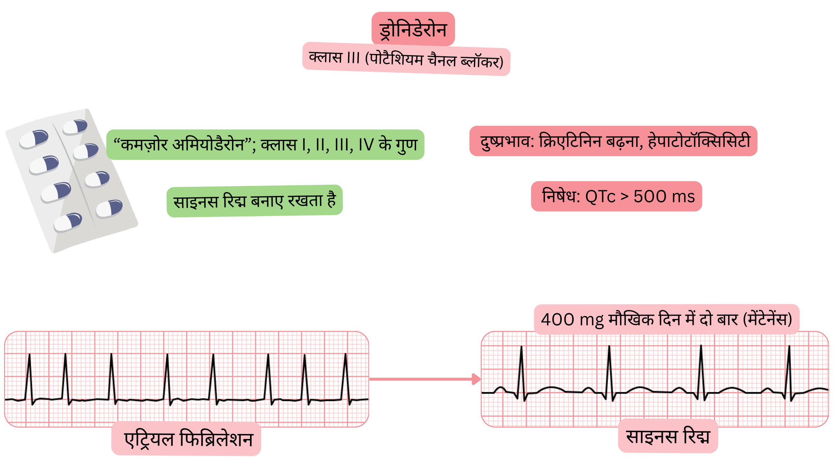 क्लास III एंटीएरिदमिक के रूप में ड्रोनडैरोन के प्रभाव का आरेख, जिसमें मल्टीचैनल क्रिया, साइनस रिद्म का संरक्षण और एट्रियल फिब्रिलेशन की औषधीय चिकित्सा दर्शाई गई है।