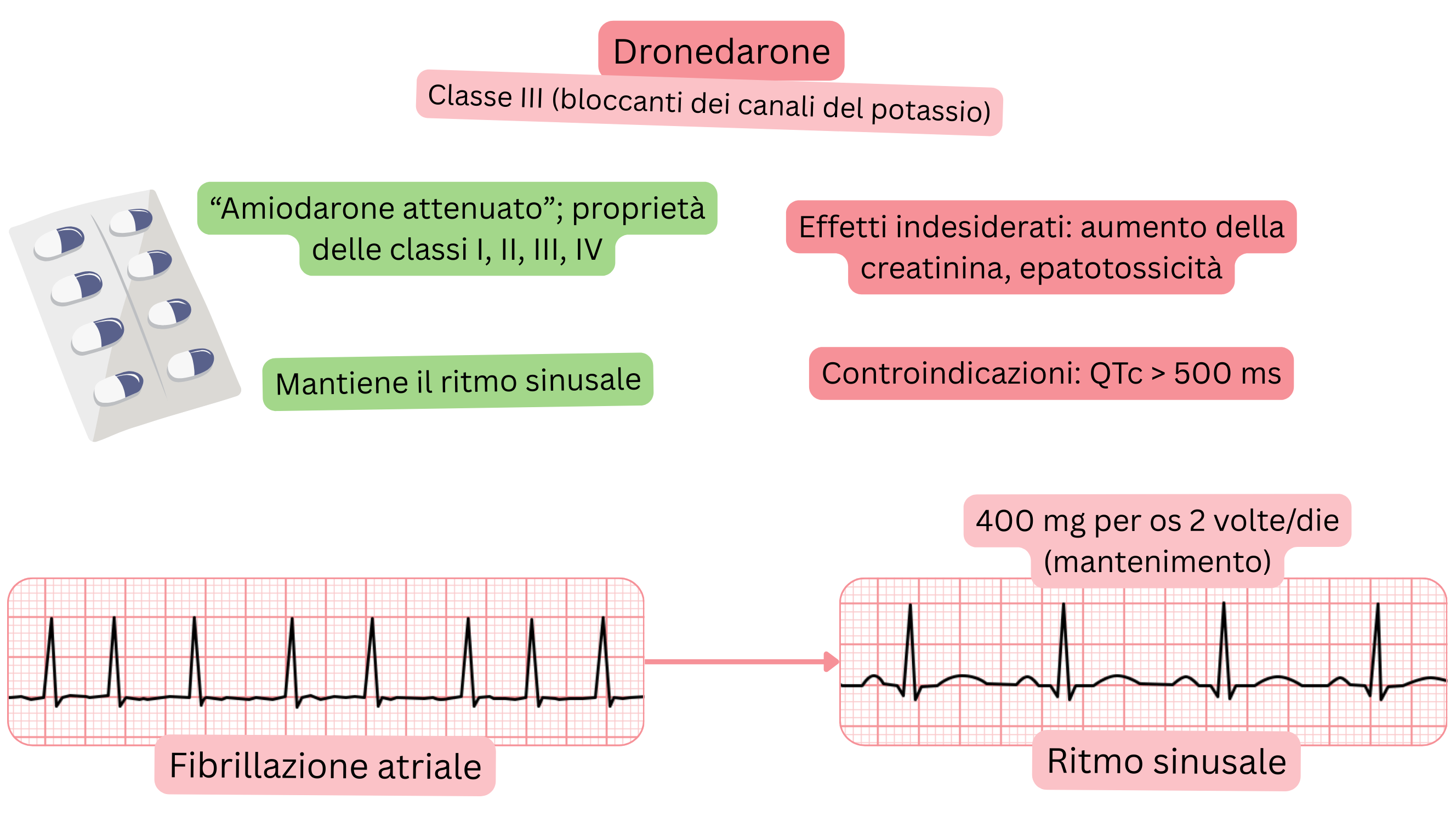 Schema dell’effetto del dronedarone come antiaritmico di classe III che illustra l’azione multicanale, il mantenimento del ritmo sinusale e il trattamento farmacologico della fibrillazione atriale.