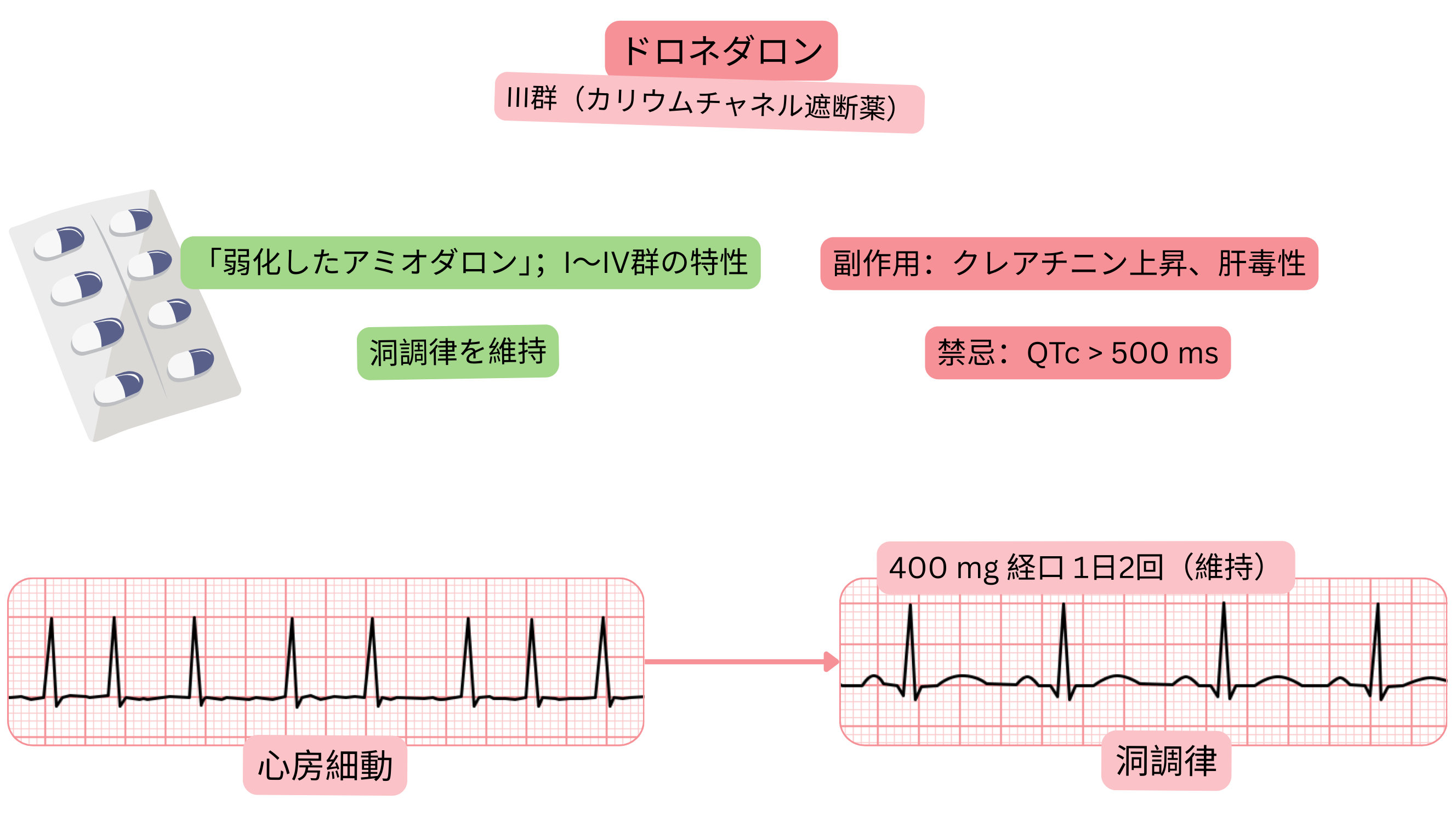 III群抗不整脈薬としてのドロネダロンの作用を示す模式図で、多チャネル作用、洞調律の維持、および心房細動の薬物療法を示す。