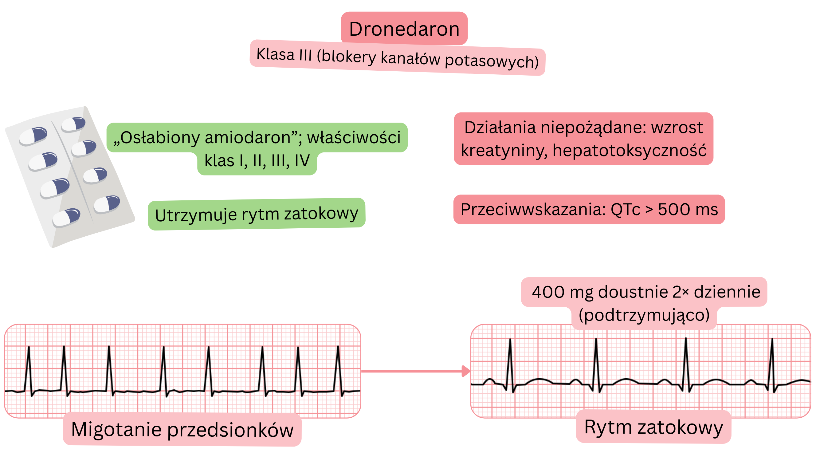Schemat działania dronedaronu jako leku antyarytmicznego klasy III, przedstawiający wielokanałowe działanie, utrzymanie rytmu zatokowego oraz farmakologiczne leczenie migotania przedsionków.