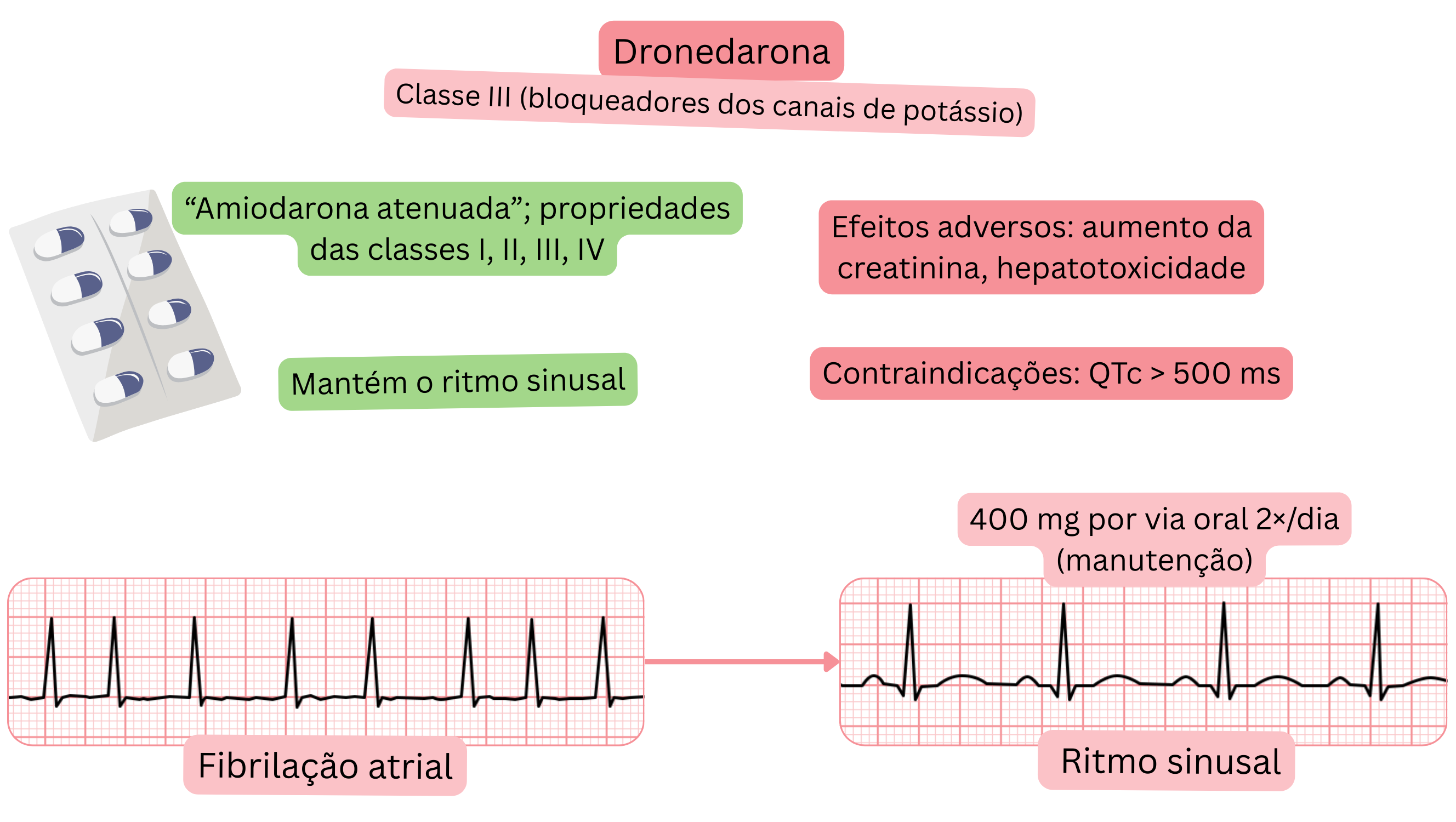 Esquema do efeito da dronedarona como antiarrítmico de classe III demonstrando ação multicanal, manutenção do ritmo sinusal e tratamento farmacológico da fibrilação atrial.