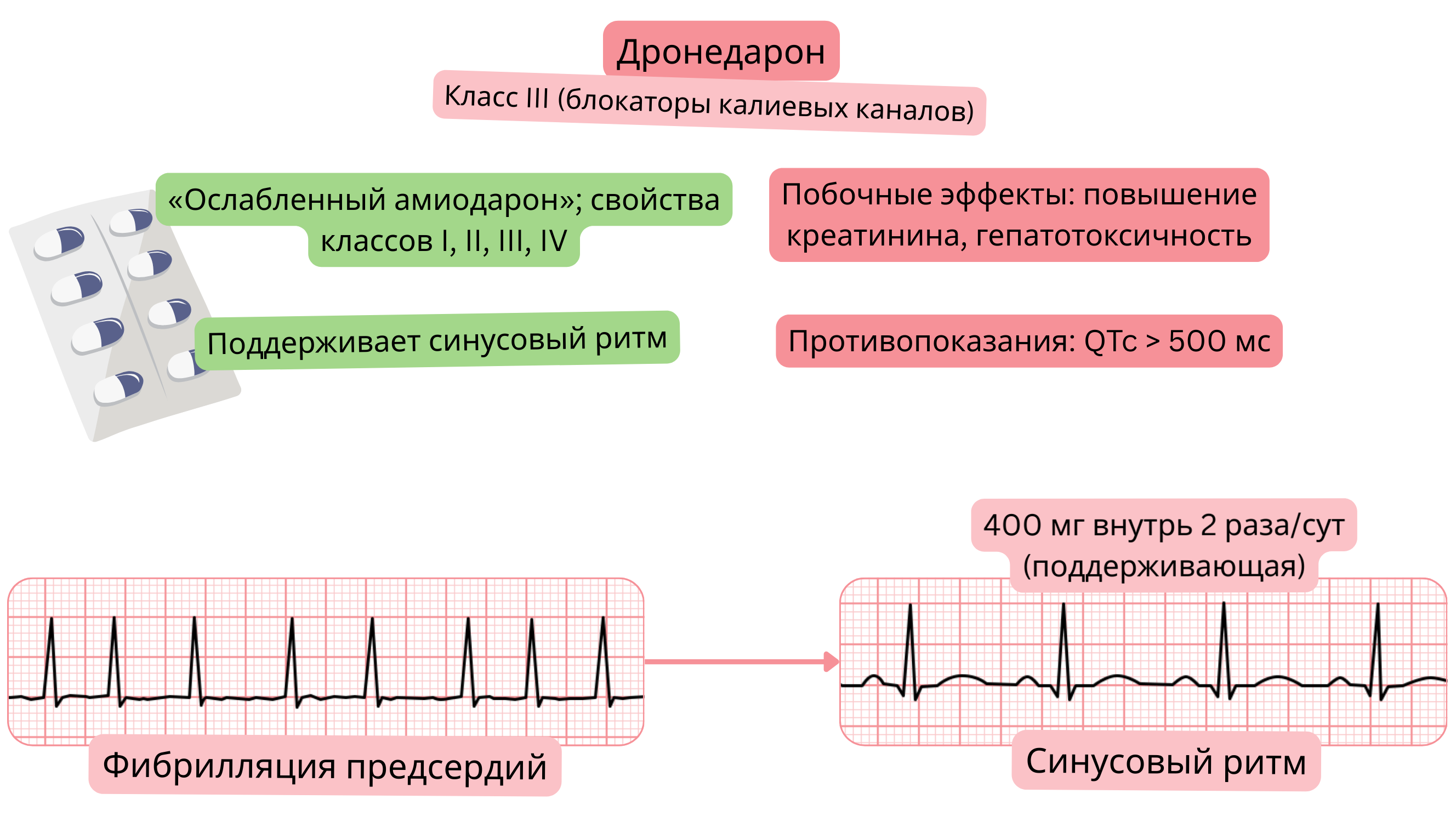 Схема действия дронедарона как антиаритмического препарата класса III, демонстрирующая мультиканальное действие, поддержание синусового ритма и фармакологическое лечение фибрилляции предсердий.