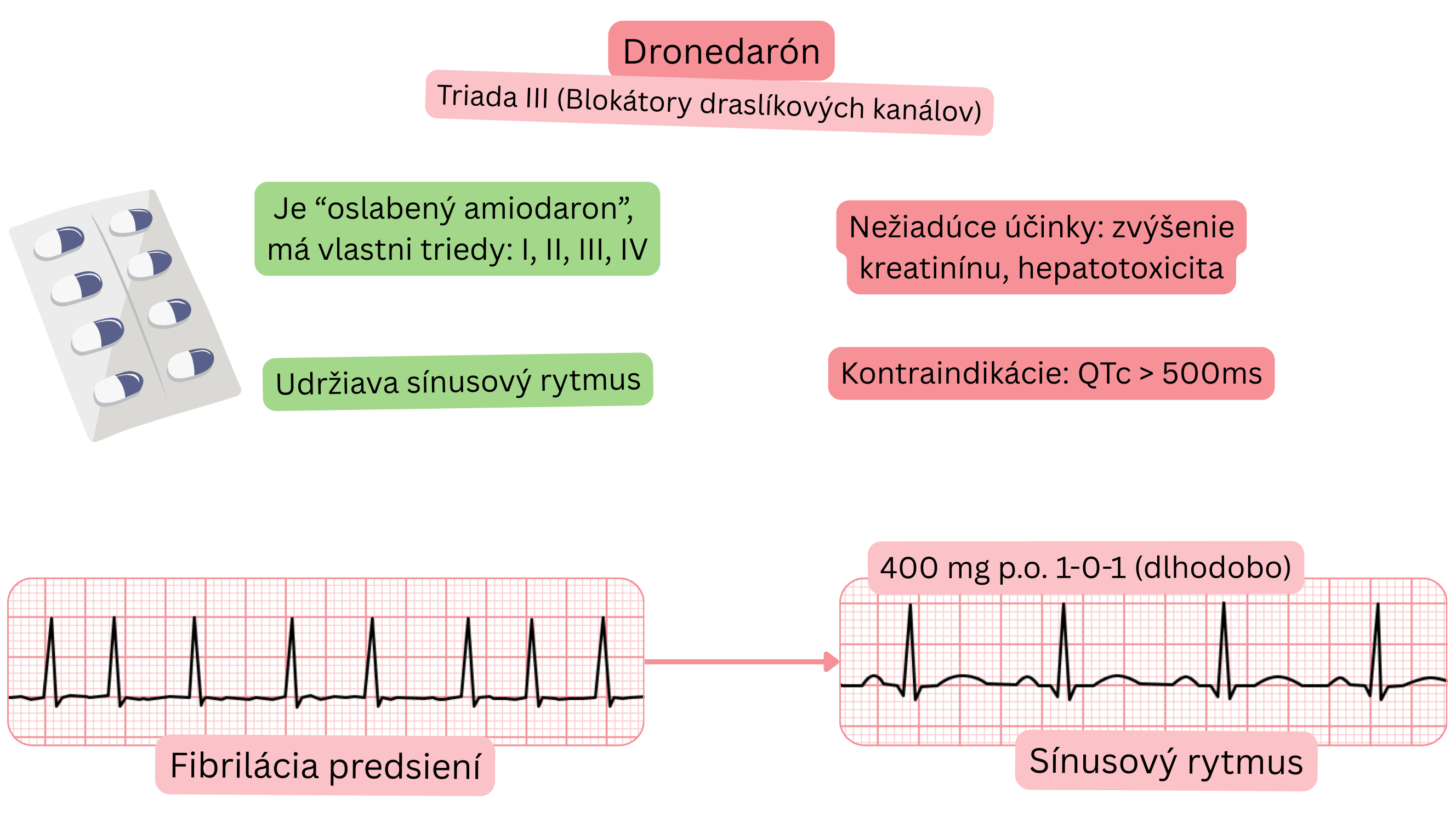 Schéma účinku dronedarónu ako antiarytmika triedy III znázorňujúca multikanálové pôsobenie, udržiavanie sínusového rytmu a farmakologickú liečbu fibrilácie predsiení.