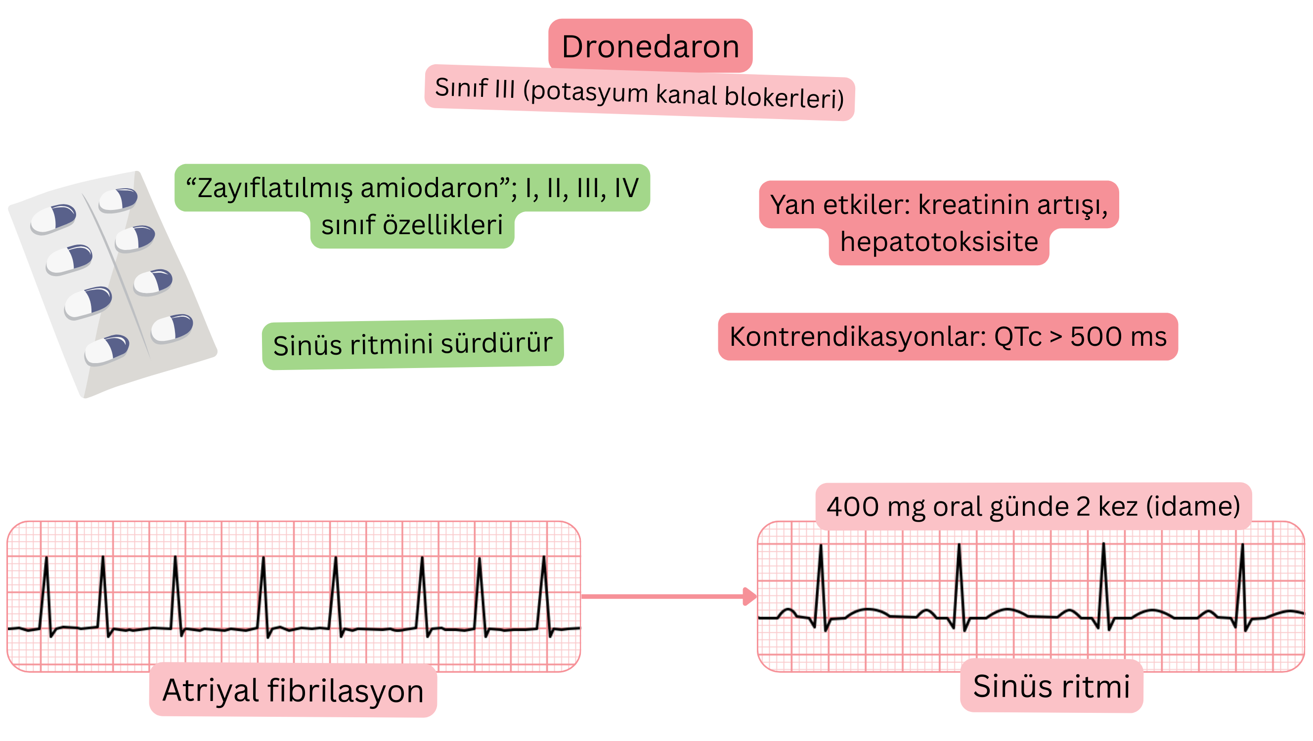 III sınıfı antiaritmik olarak dronedaronun etkisini gösteren şema; çok kanallı etkiyi, sinüs ritminin sürdürülmesini ve atriyal fibrilasyonun farmakolojik tedavisini göstermektedir.