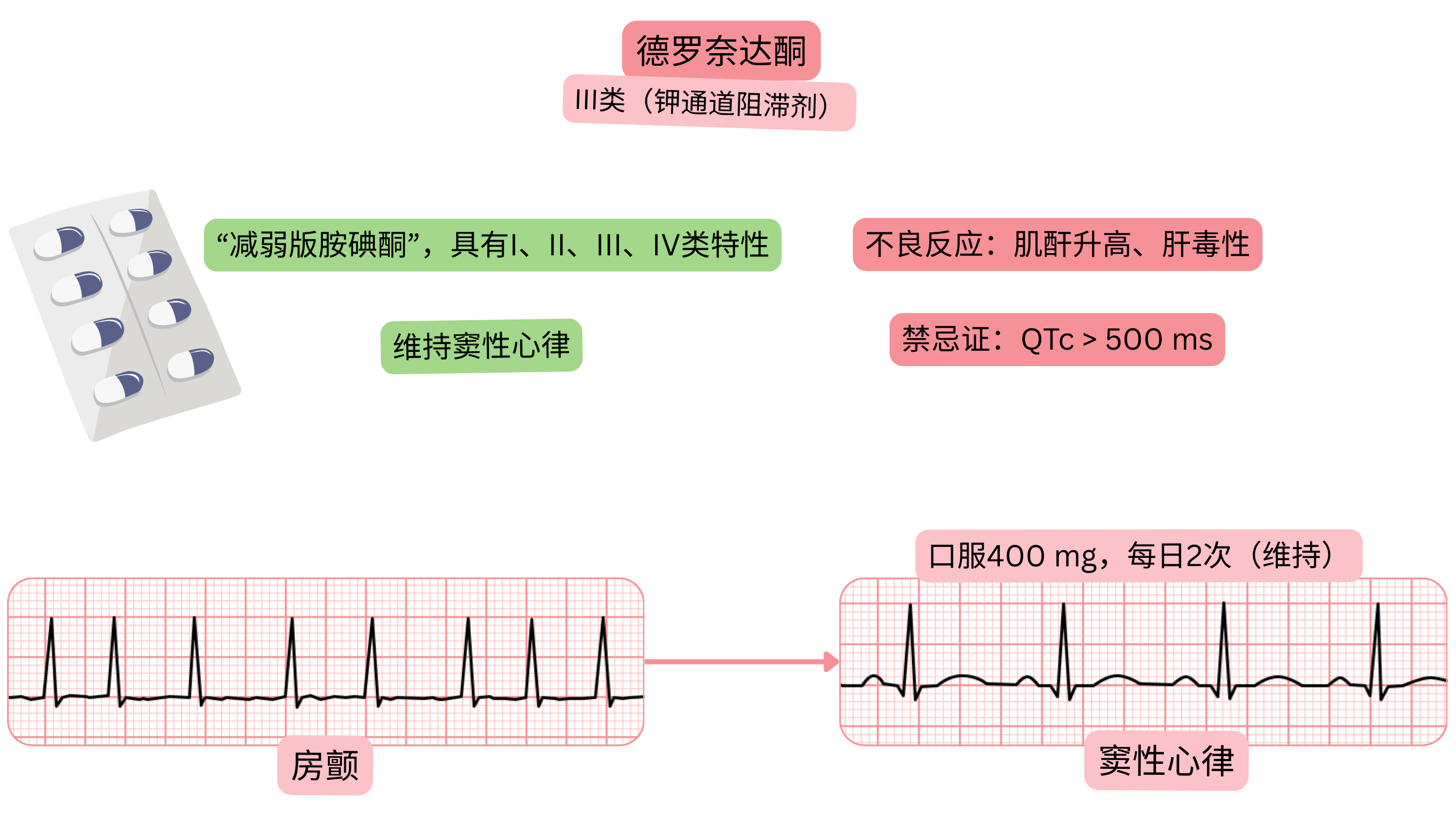 德罗奈达酮作为III类抗心律失常药物的作用示意图，显示其多通道作用、维持窦性心律及心房颤动的药物治疗。