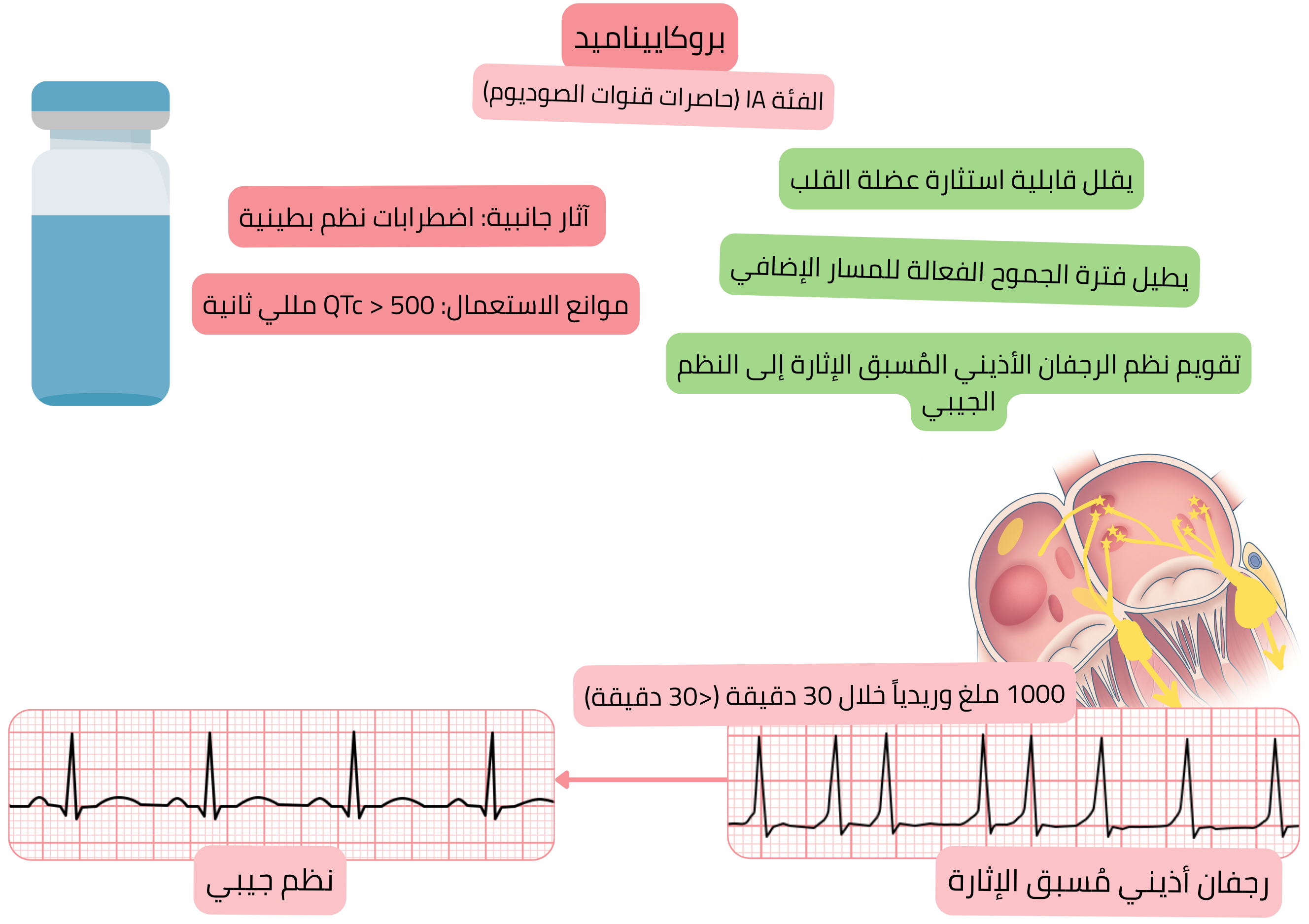مخطط تأثير البروكاييناميد كمضاد اضطراب نظم من الفئة IA يوضح انخفاض قابلية استثارة عضلة القلب، وإطالة الفترة المقاومة الفعالة للمسار الإضافي، والتقويم القلبي الدوائي للرجفان الأذيني المُسبق الإثارة إلى النظم الجيبي.