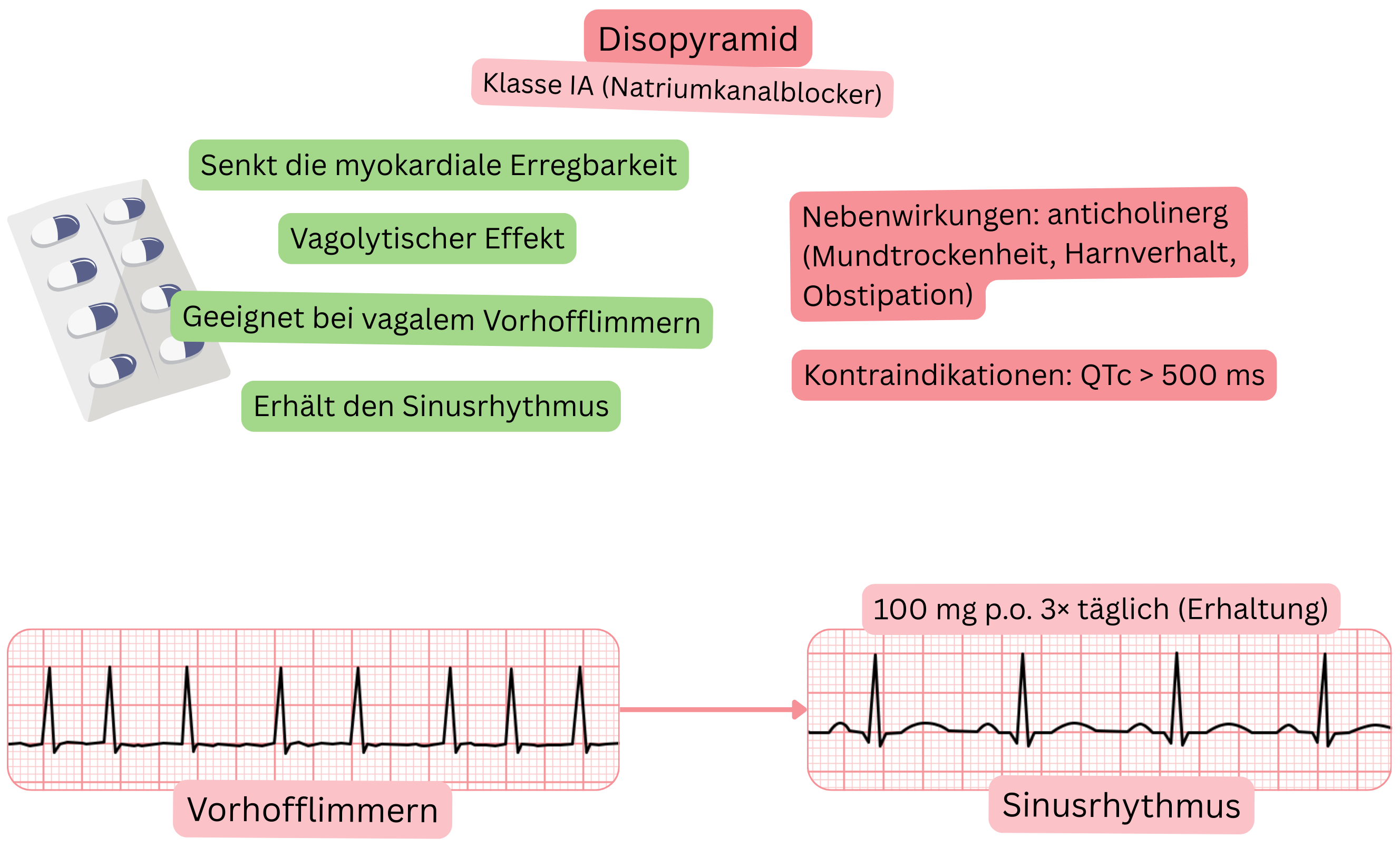 Schema der Wirkung von Disopyramid als Antiarrhythmikum der Klasse IA mit Darstellung eines vagolytischen Effekts, der Reduktion der myokardialen Erregbarkeit und der Aufrechterhaltung des Sinusrhythmus bei vagal vermitteltem Vorhofflimmern.
