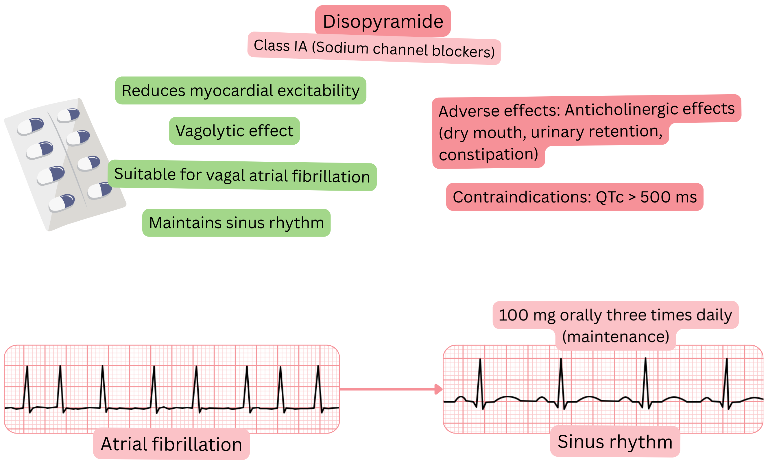 Diagram of the effect of disopyramide as a class IA antiarrhythmic illustrating a vagolytic effect, reduced myocardial excitability, and maintenance of sinus rhythm in vagally mediated atrial fibrillation.