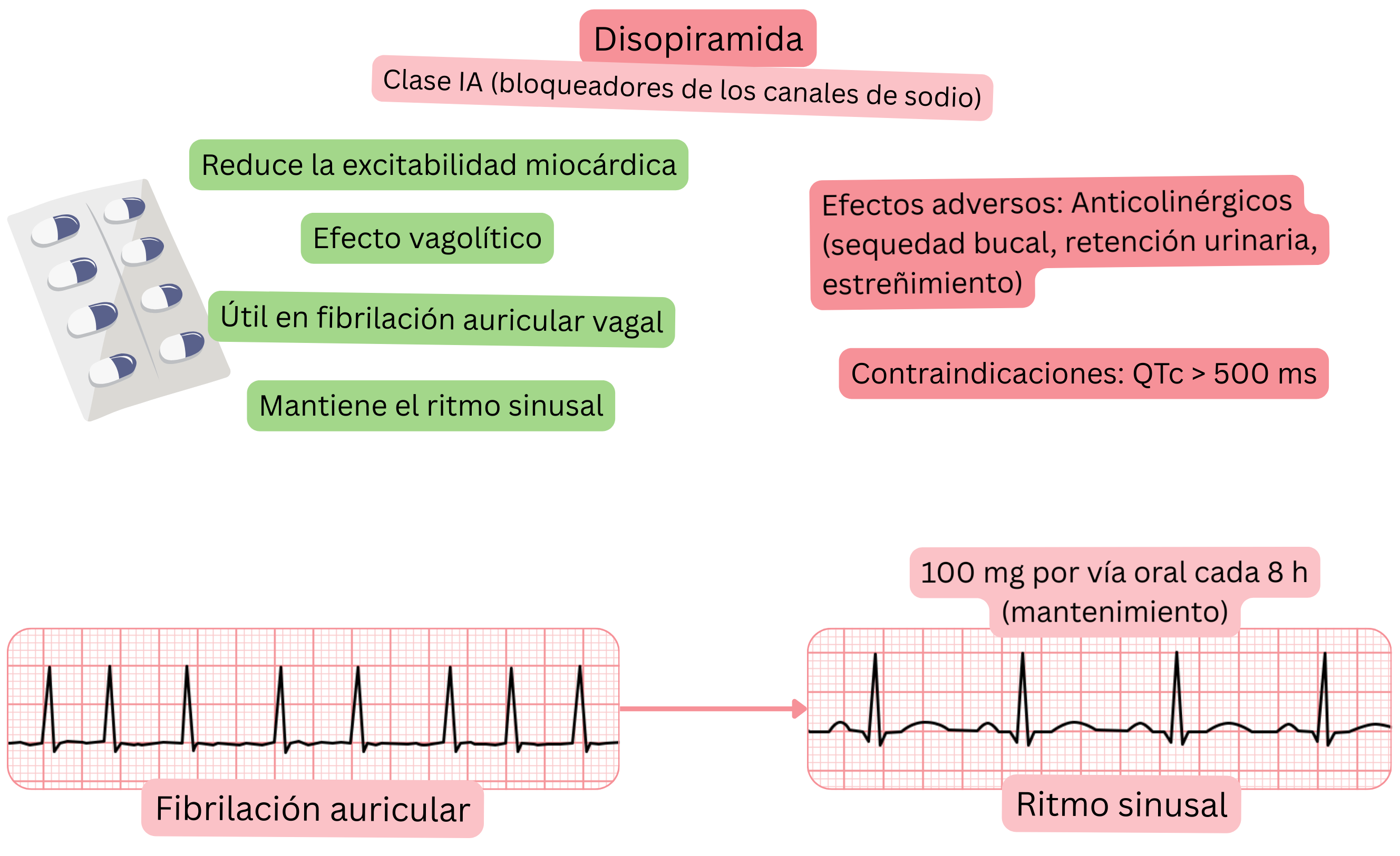 Esquema del efecto de la disopiramida como antiarrítmico de clase IA que muestra un efecto vagolítico, reducción de la excitabilidad miocárdica y mantenimiento del ritmo sinusal en la fibrilación auricular vagal.