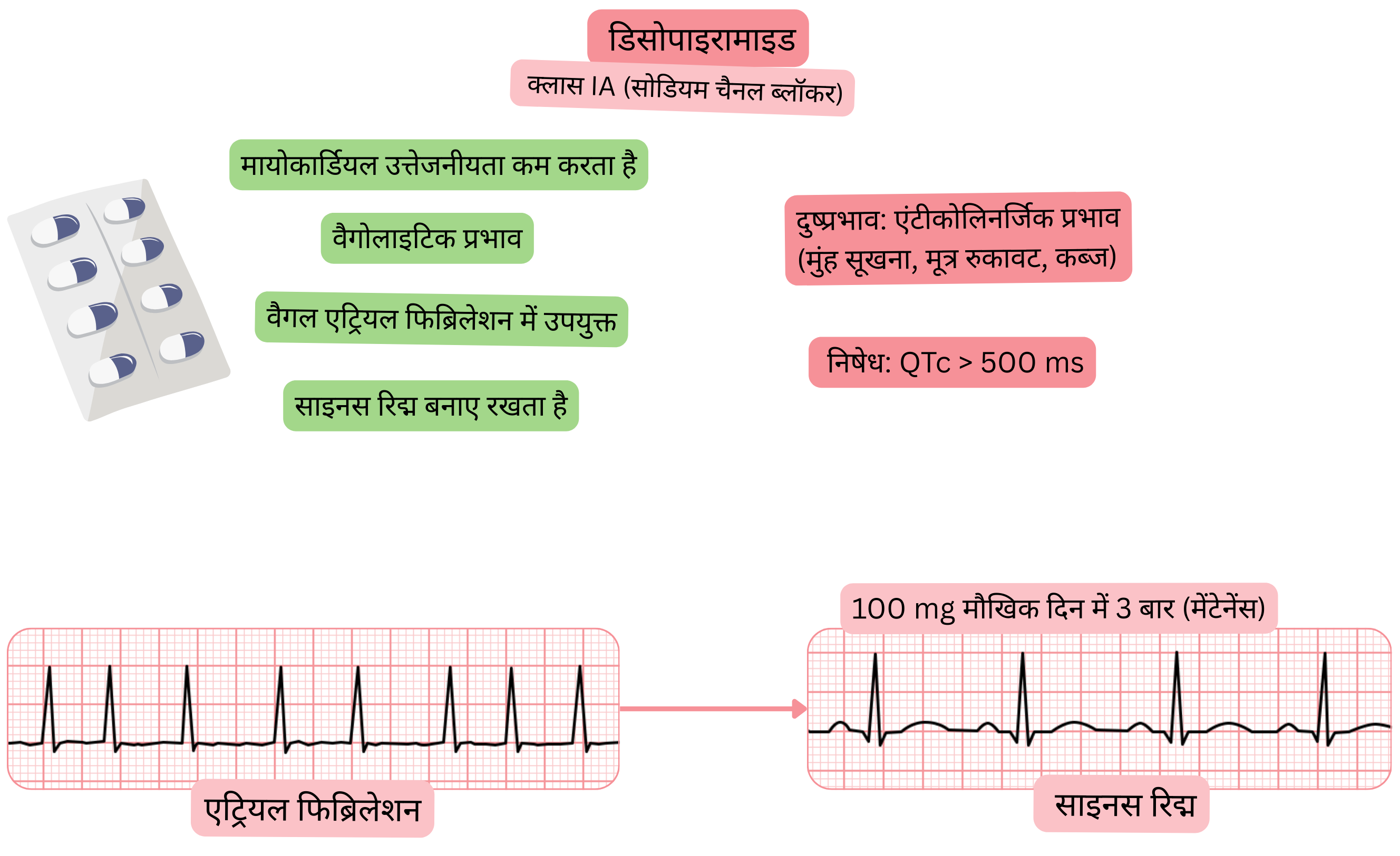 क्लास IA एंटीएरिदमिक के रूप में डिसोपिरामाइड के प्रभाव का आरेख, जिसमें वेगोलाइटिक प्रभाव, मायोकार्डियल उत्तेजनीयता में कमी और वेगल-जनित एट्रियल फिब्रिलेशन में साइनस रिद्म का संरक्षण दर्शाया गया है।