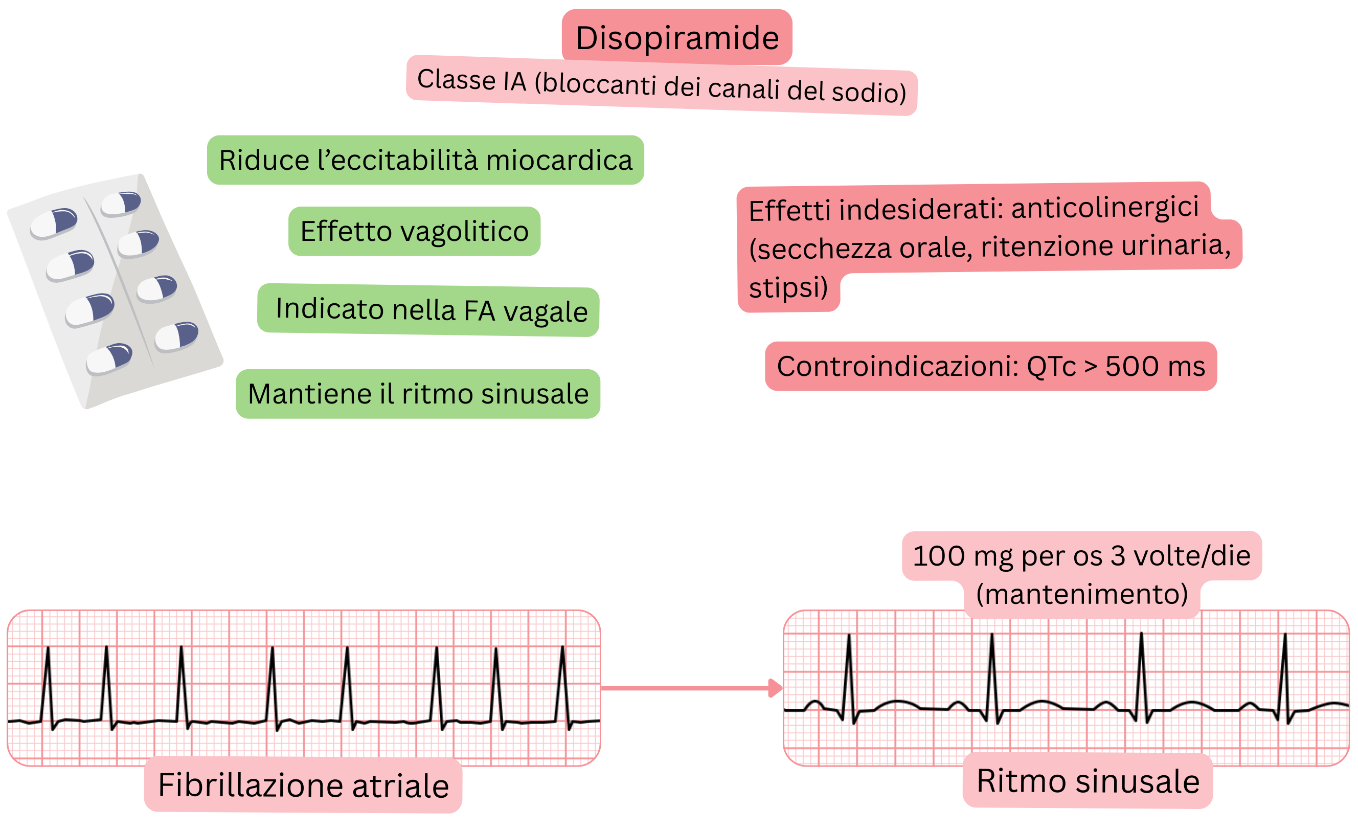 Schema dell’effetto della disopiramide come antiaritmico di classe IA che illustra l’effetto vagolitico, la riduzione dell’eccitabilità miocardica e il mantenimento del ritmo sinusale nella fibrillazione atriale vagale.