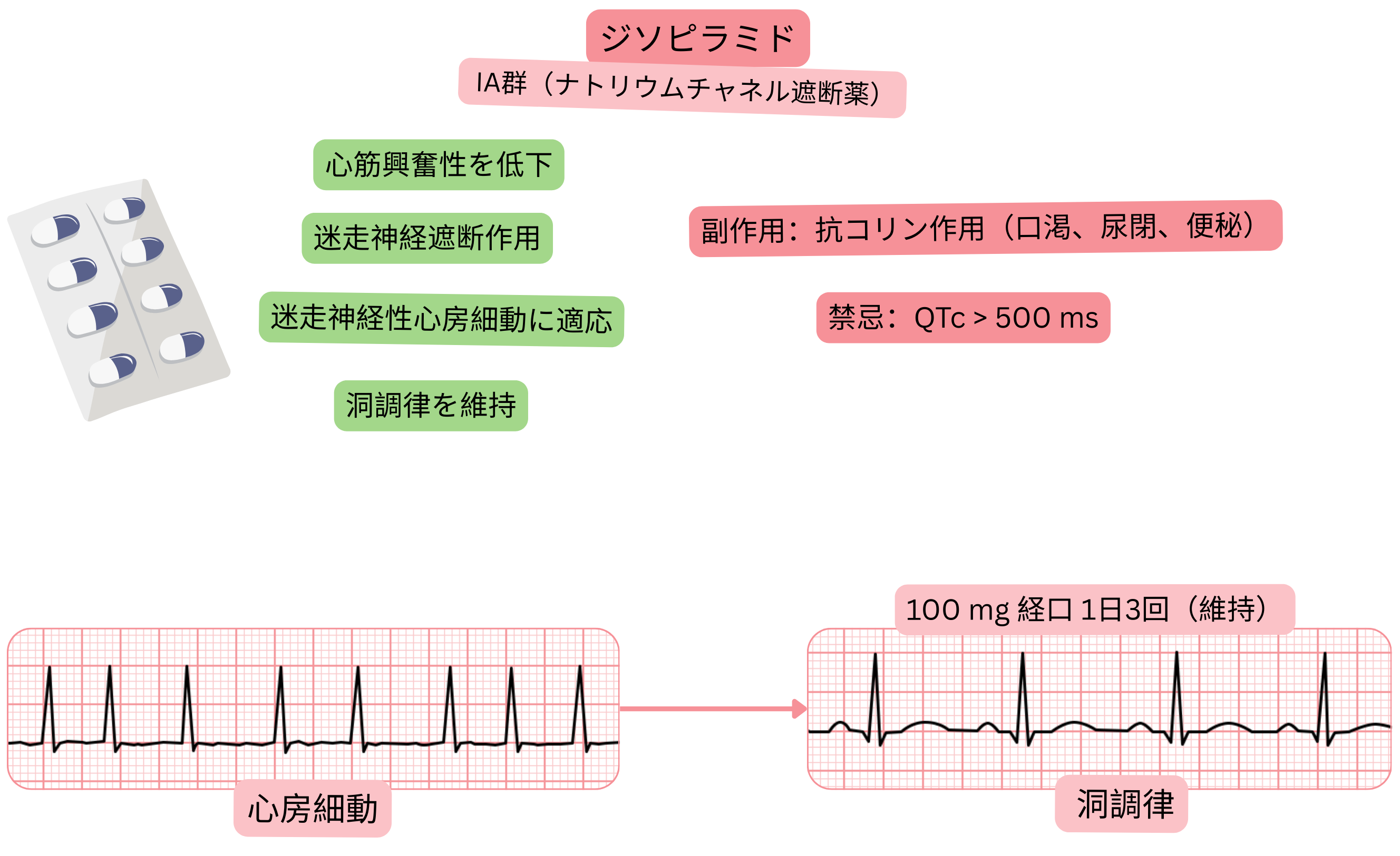 IA群抗不整脈薬としてのジソピラミドの作用を示す模式図で、抗迷走神経作用、心筋興奮性低下、および迷走神経性心房細動における洞調律維持を示す。