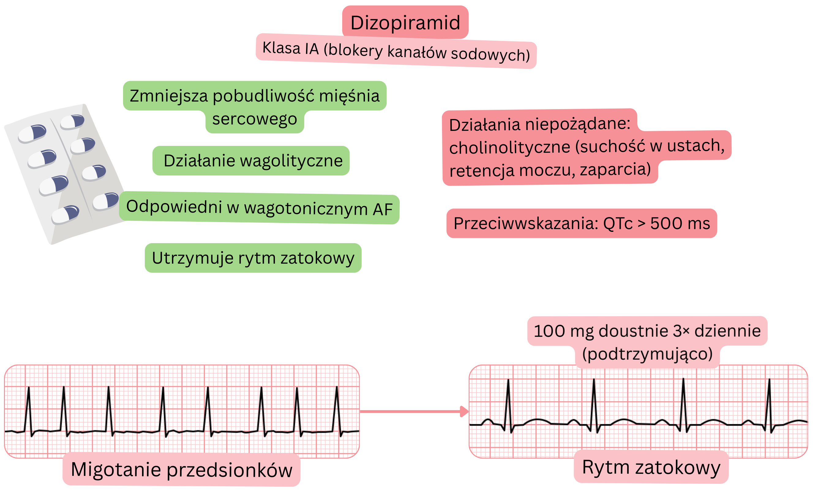 Schemat działania dizopiramidu jako leku antyarytmicznego klasy IA, przedstawiający efekt wagolityczny, zmniejszenie pobudliwości mięśnia sercowego oraz utrzymanie rytmu zatokowego w migotaniu przedsionków o podłożu wagalnym.