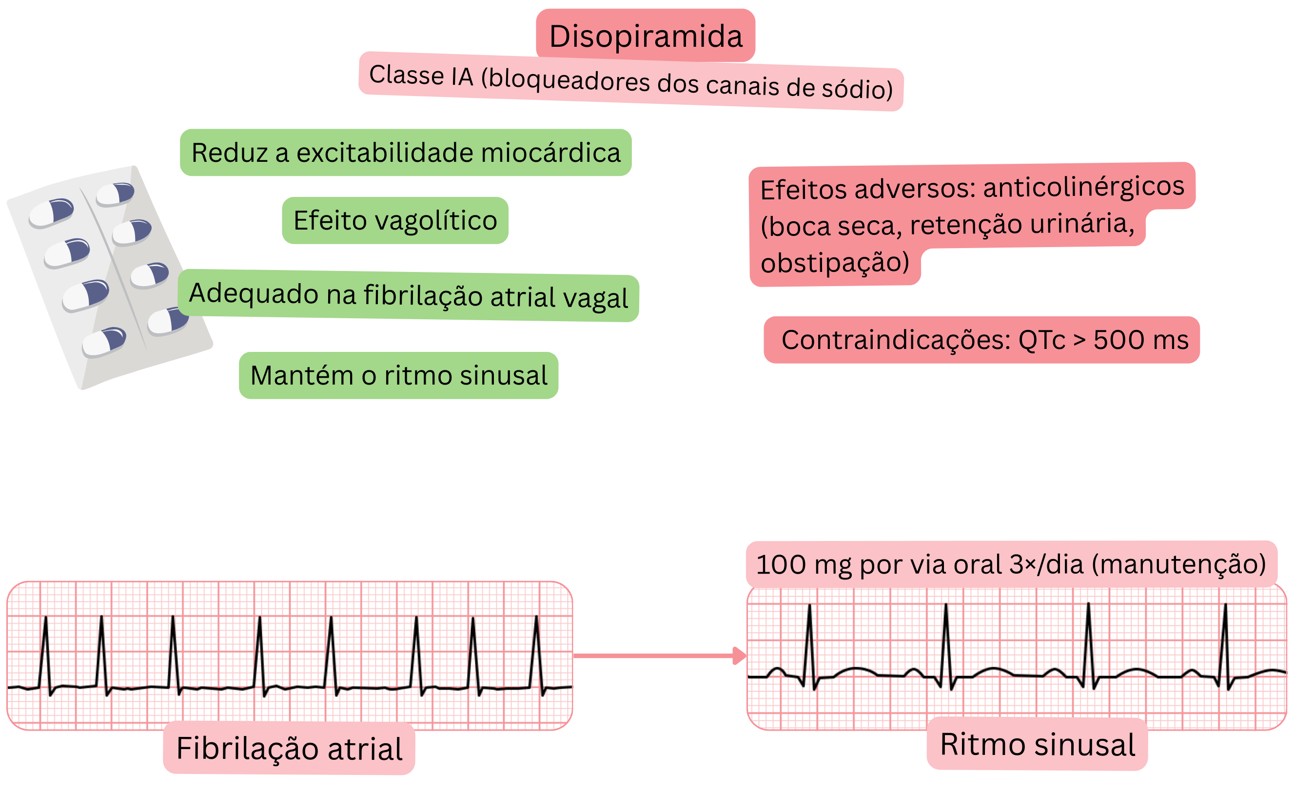Esquema do efeito da disopiramida como antiarrítmico de classe IA demonstrando efeito vagolítico, redução da excitabilidade miocárdica e manutenção do ritmo sinusal na fibrilação atrial vagal.