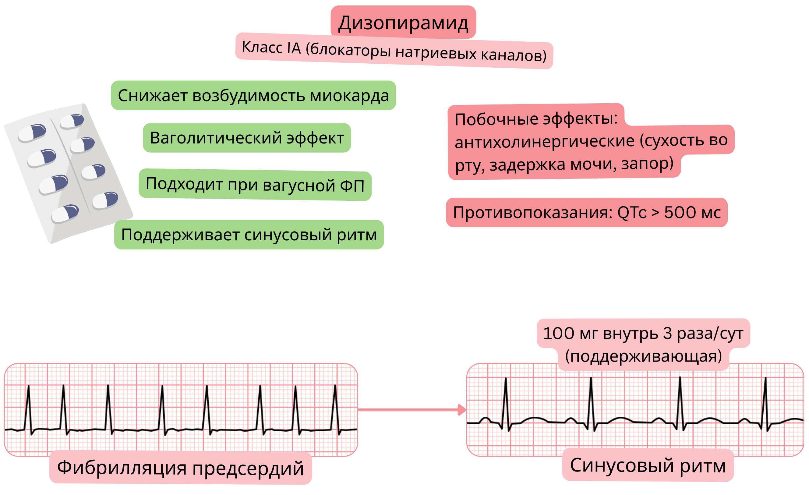 Схема действия дизопирамида как антиаритмического препарата класса IA, демонстрирующая ваголитический эффект, снижение возбудимости миокарда и поддержание синусового ритма при вагус-индуцированной фибрилляции предсердий.