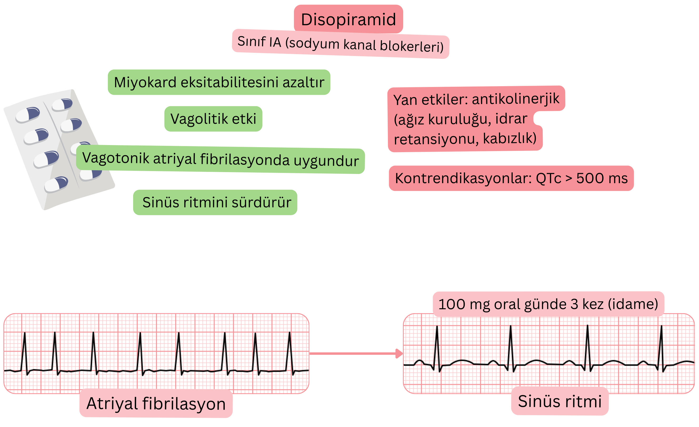 IA sınıfı antiaritmik olarak disopiramidin etkisini gösteren şema; vagolitik etkiyi, miyokard uyarılabilirliğinin azalmasını ve vagal atriyal fibrilasyonda sinüs ritminin sürdürülmesini göstermektedir.