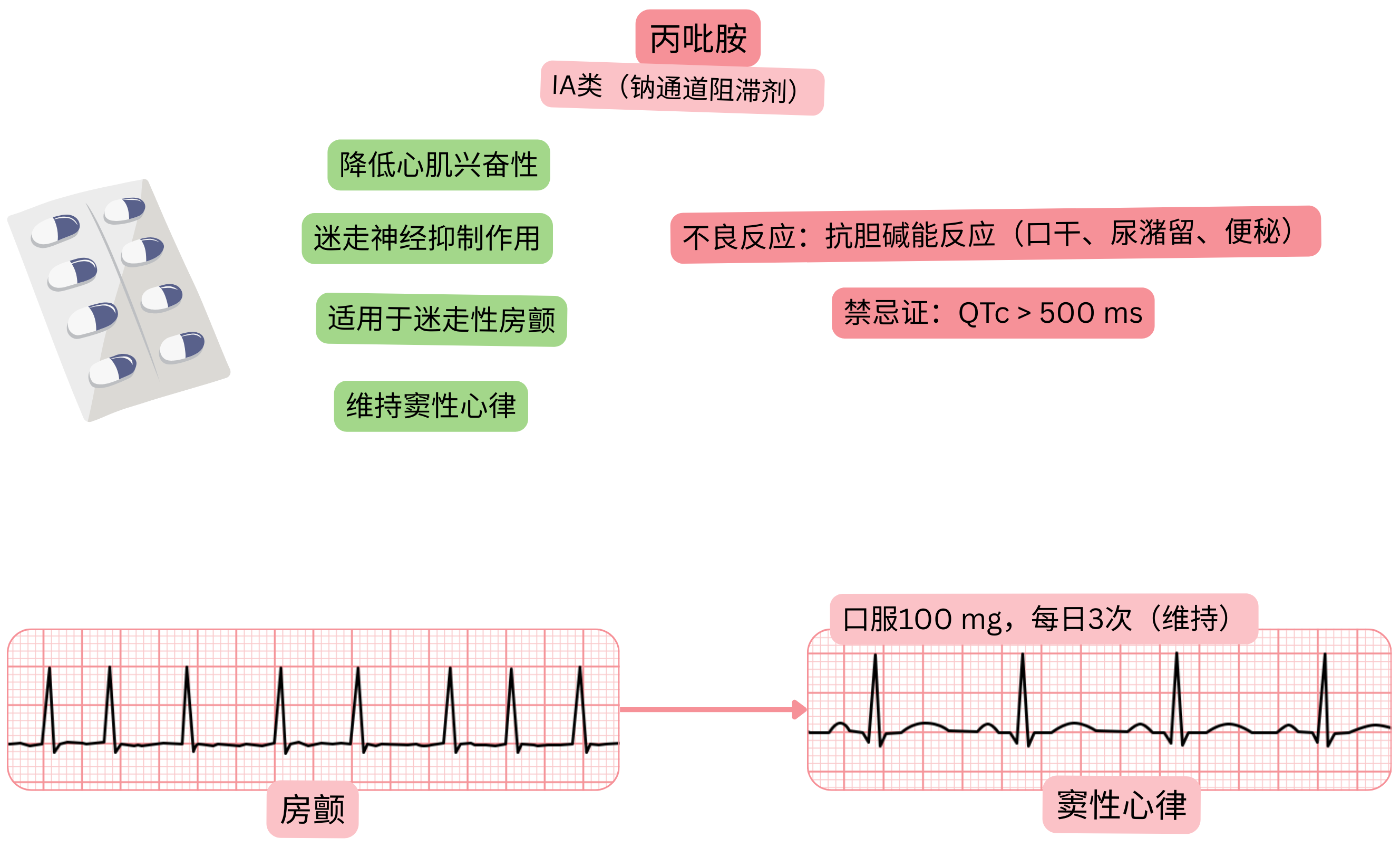丙吡胺作为IA类抗心律失常药物的作用示意图，显示迷走神经阻断效应、心肌兴奋性降低以及在迷走性心房颤动中维持窦性心律。
