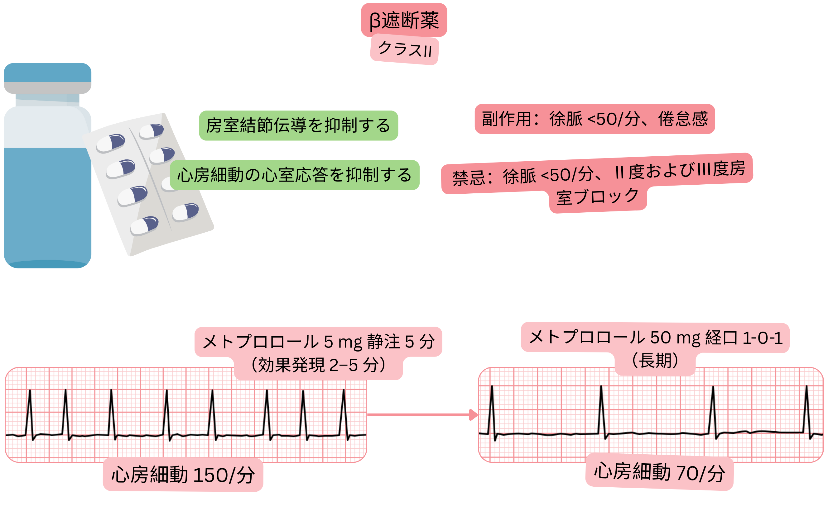 II群抗不整脈薬であるβ遮断薬の作用を示す模式図で、房室結節伝導の遅延と心房細動時の心室応答低下を示す。