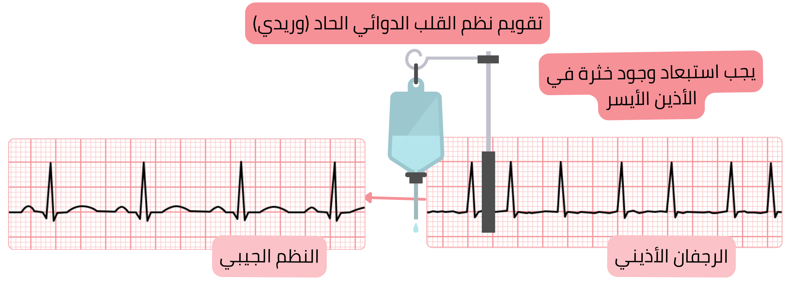مخطط التقويم القلبي الدوائي الحاد للرجفان الأذيني باستخدام مضادات اضطراب النظم الوريدية، مع الإلزام باستبعاد خثرة في الأذين الأيسر قبل استعادة النظم الجيبي.