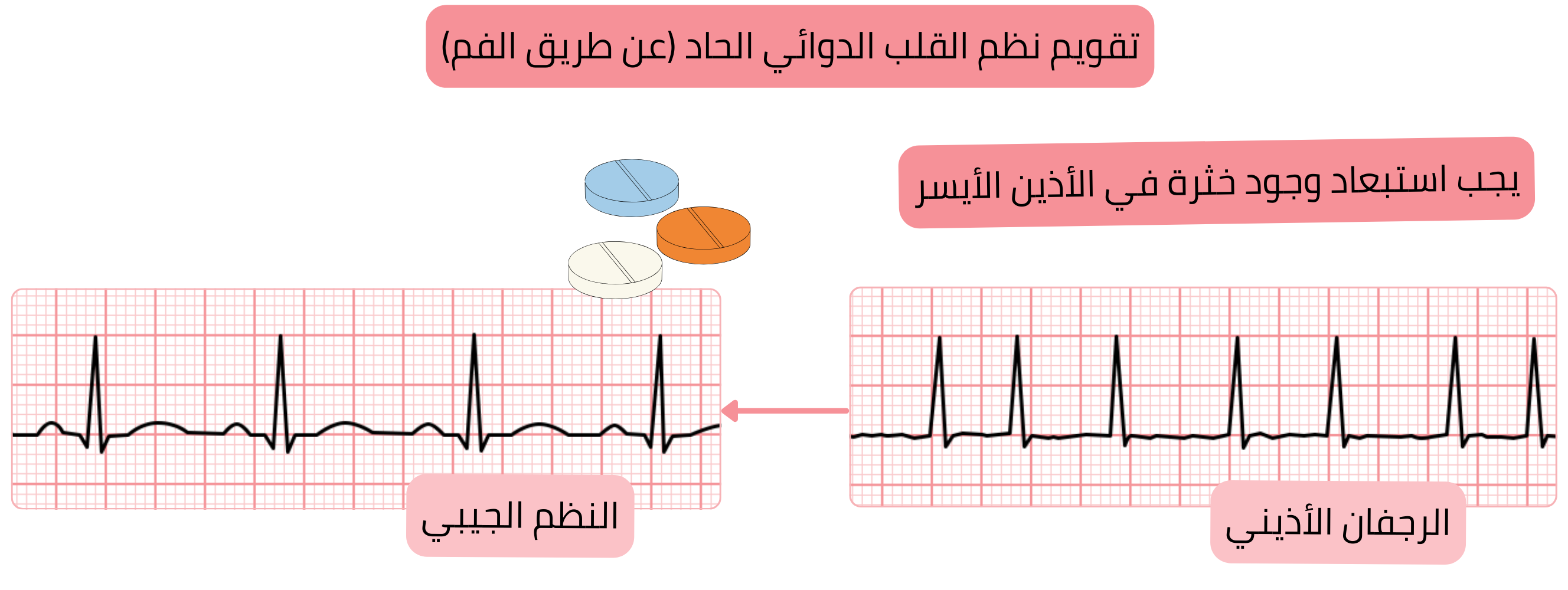 مخطط التقويم القلبي الدوائي الحاد للرجفان الأذيني باستخدام مضادات اضطراب النظم الفموية، مع التأكيد على ضرورة استبعاد خثرة في الأذين الأيسر قبل استعادة النظم الجيبي.