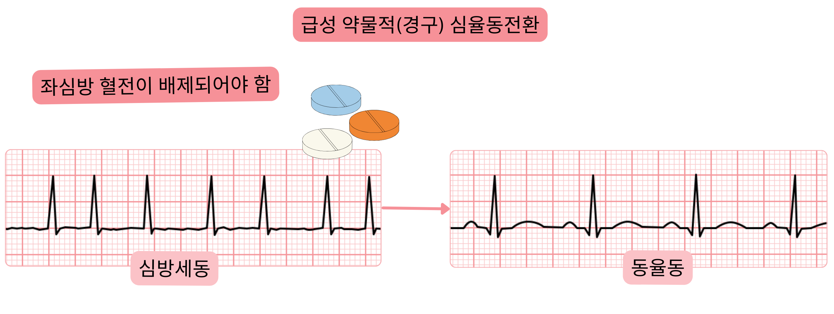 경구 항부정맥제를 이용한 심방세동의 급성 약물적 심율동전환을 나타낸 도식으로, 동율동 회복 전에 좌심방 혈전 배제가 필요함을 보여준다.