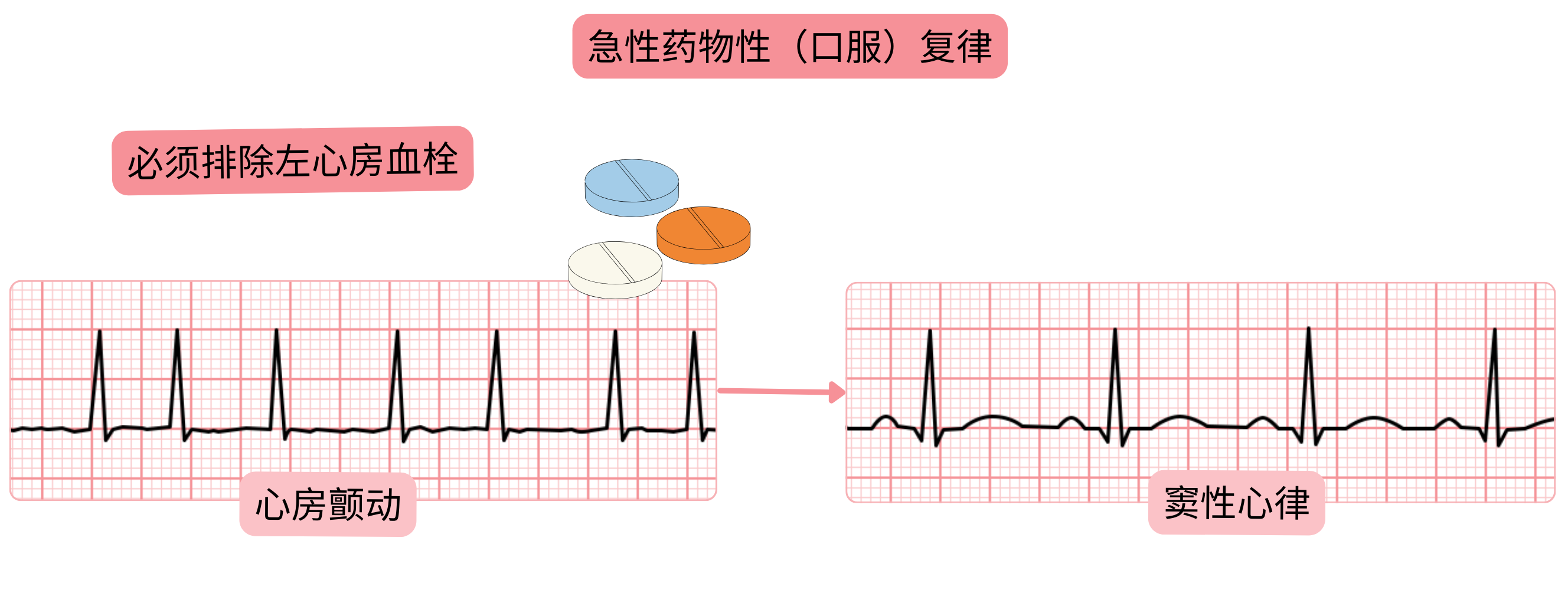 口服抗心律失常药物进行心房颤动急性药物复律的示意图，强调在恢复窦性心律前需排除左心房血栓。