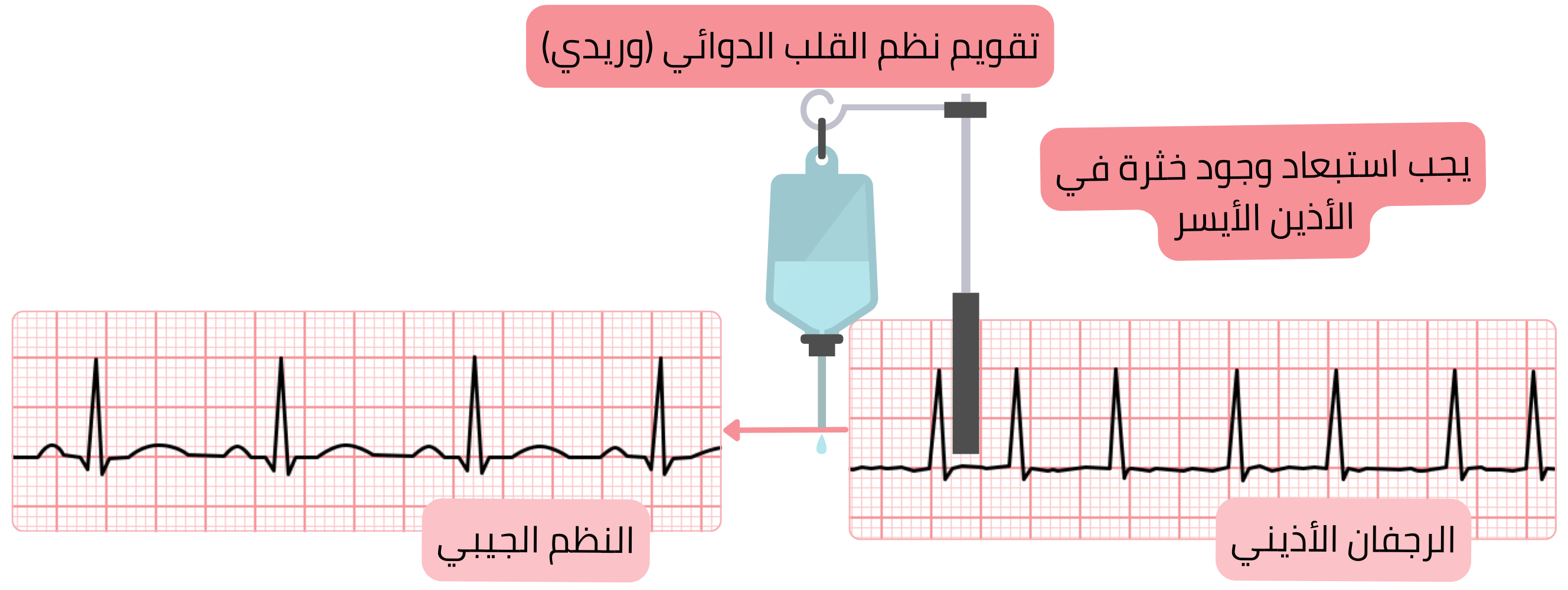 مخطط التقويم القلبي الدوائي للرجفان الأذيني باستخدام مضادات اضطراب النظم الوريدية، مع التأكيد على ضرورة استبعاد خثرة في الأذين الأيسر قبل استعادة النظم الجيبي.