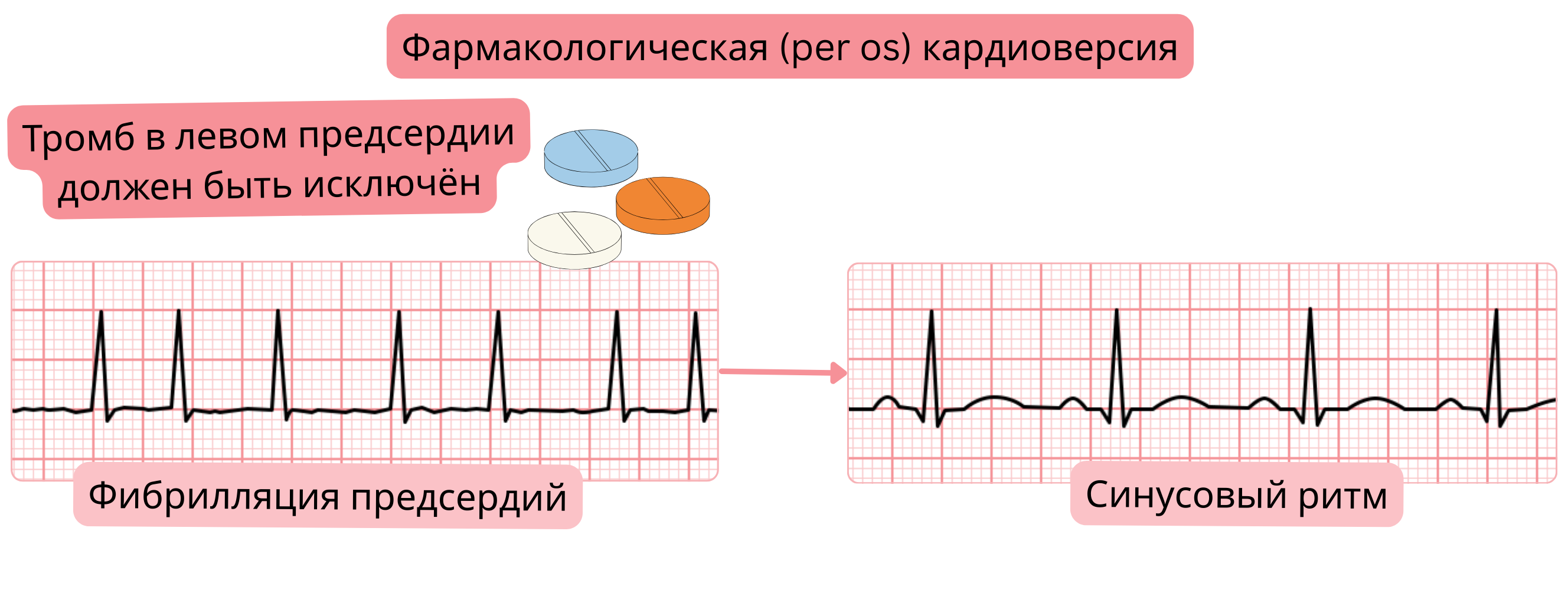 Схема фармакологической кардиоверсии фибрилляции предсердий пероральными антиаритмическими препаратами с необходимостью исключения тромба в левом предсердии перед восстановлением синусового ритма.