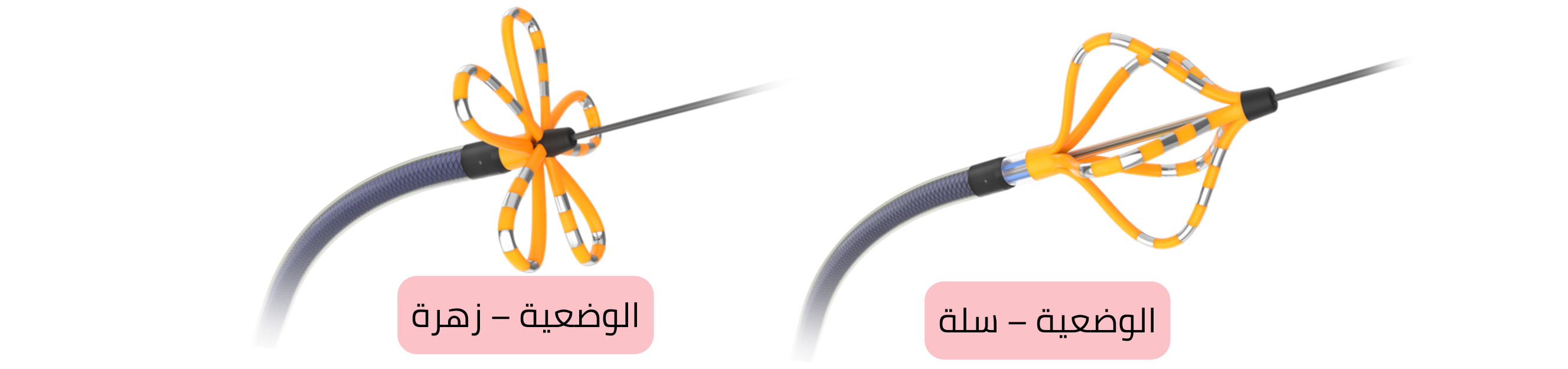 مخطط قسطرة الاستئصال أثناء استئصال الرجفان الأذيني يوضح وضعيتي السلة والزهرة المستخدمتين في عزل الأوردة الرئوية.