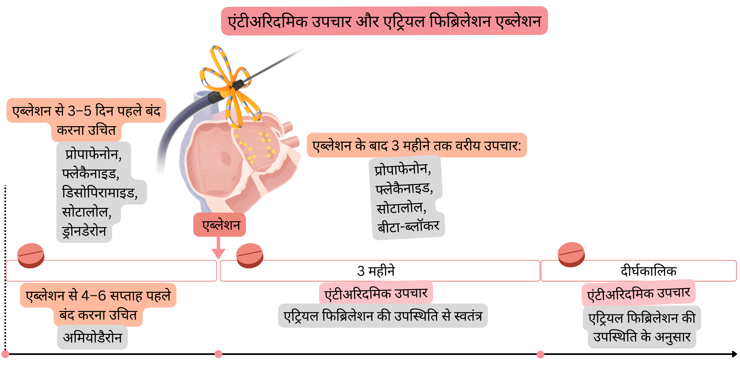 एट्रियल फिब्रिलेशन की कैथेटर एब्लेशन से संबंधित एंटीएरिदमिक उपचार प्रबंधन का आरेख, जिसमें प्रक्रिया से पहले दवाओं का बंद करना, पहले तीन महीनों के दौरान पसंदीदा उपचार तथा एट्रियल फिब्रिलेशन की उपस्थिति के आधार पर दीर्घकालिक रणनीति दर्शाई गई है।