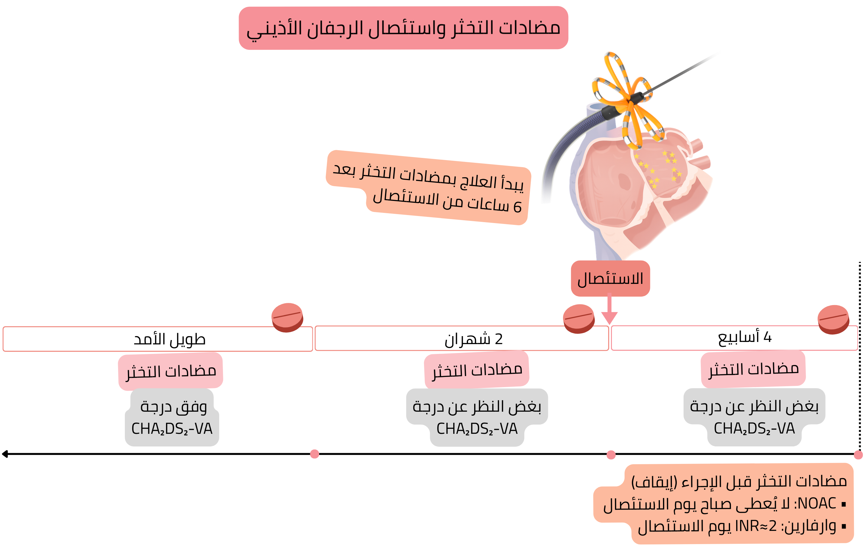 مخطط تدبير العلاج بمضادات التخثر في الاستئصال بالقسطرة للرجفان الأذيني يوضح الخطة قبل الإجراء، مباشرة بعد الاستئصال، خلال أول شهرين، واتخاذ القرار طويل الأمد وفق درجة CHA₂DS₂-VA.