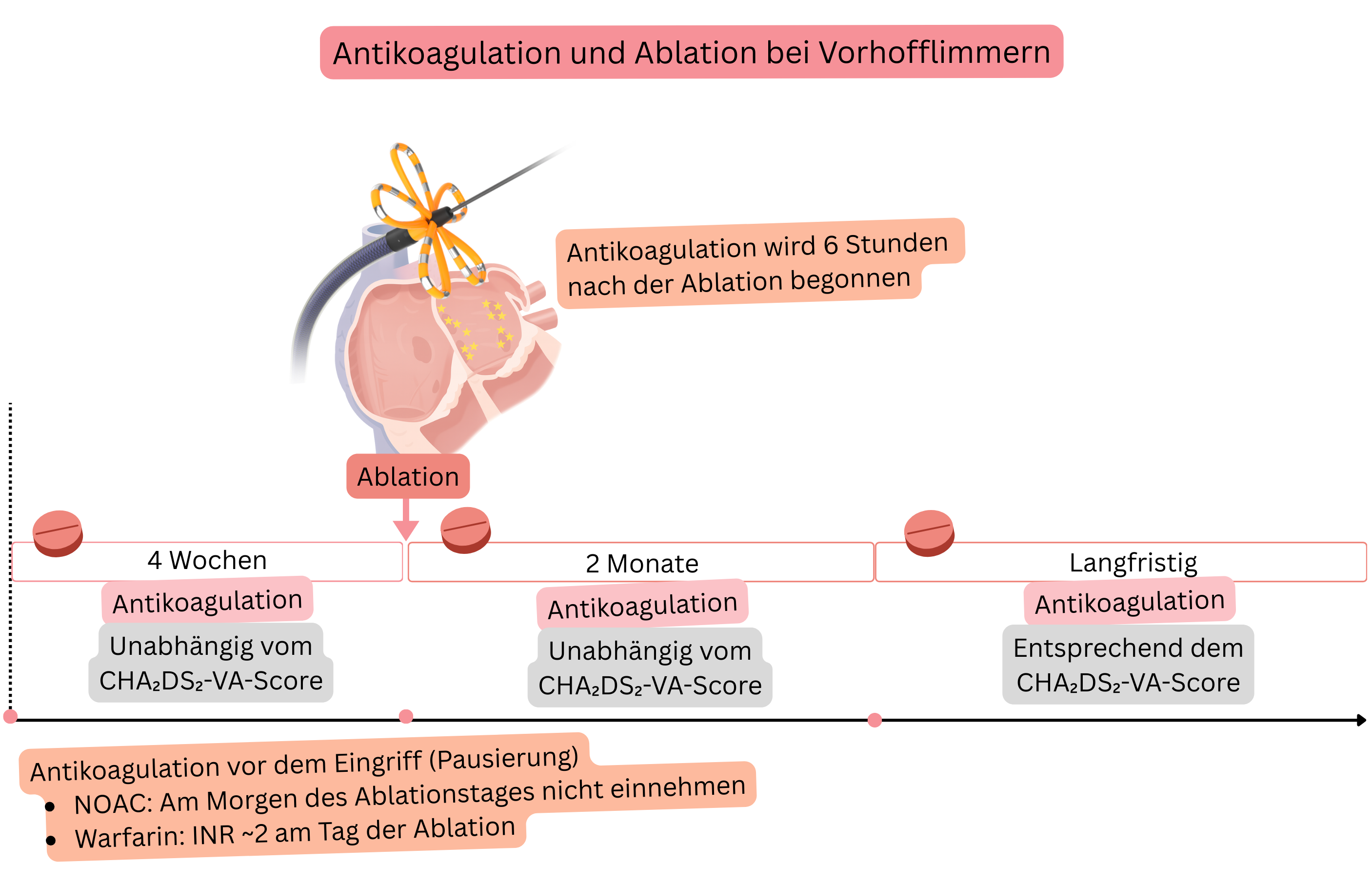 Schema des Antikoagulationsmanagements bei Katheterablation von Vorhofflimmern mit Darstellung des Vorgehens vor dem Eingriff, unmittelbar nach der Ablation, während der ersten 2 Monate und der langfristigen Entscheidung anhand des CHA₂DS₂-VA-Scores.