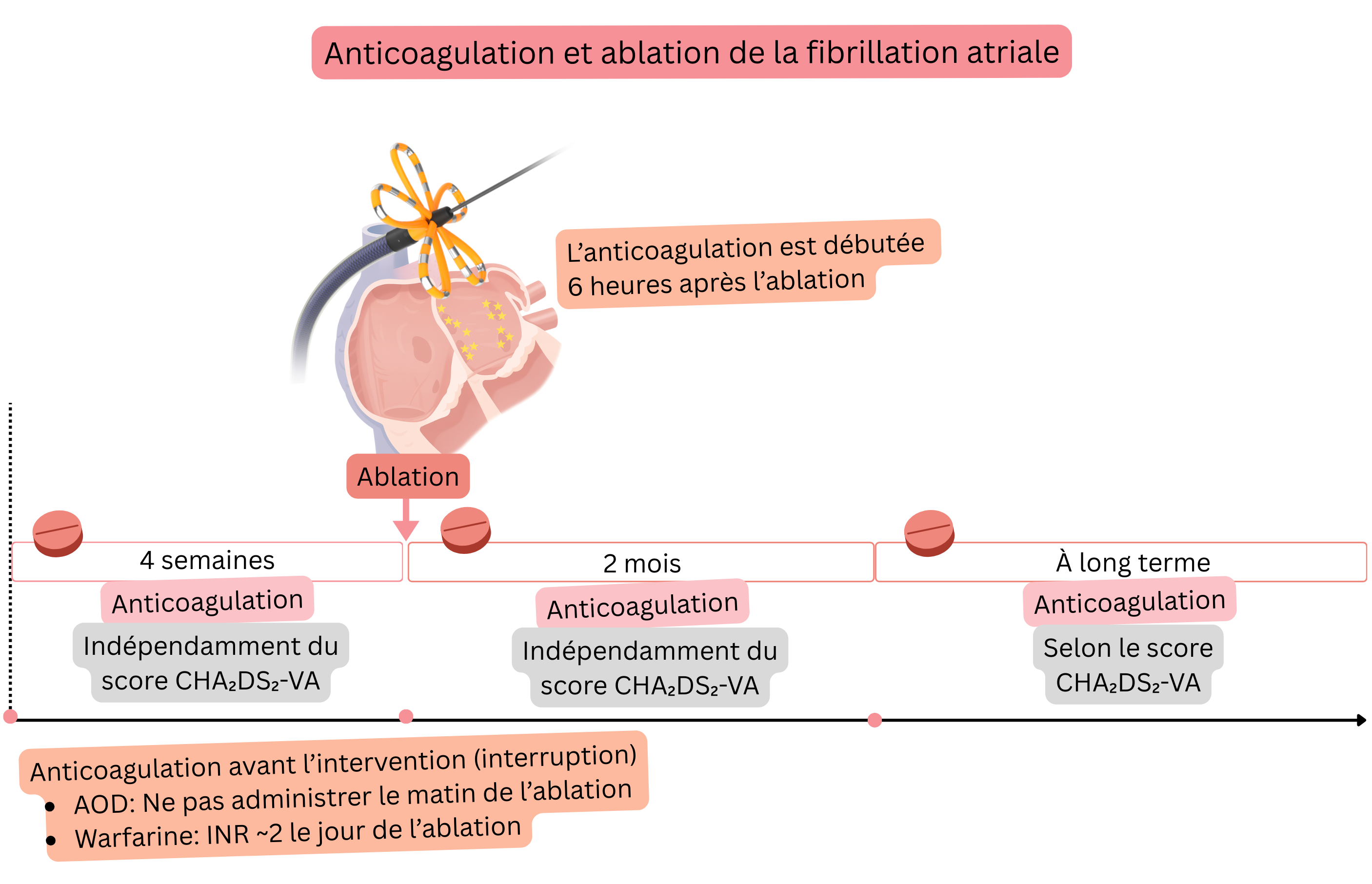 Schéma de la prise en charge du traitement anticoagulant lors de l’ablation par cathéter de la fibrillation atriale, illustrant la stratégie préprocédurale, immédiatement après l’ablation, durant les 2 premiers mois et la décision à long terme selon le score CHA₂DS₂-VA.