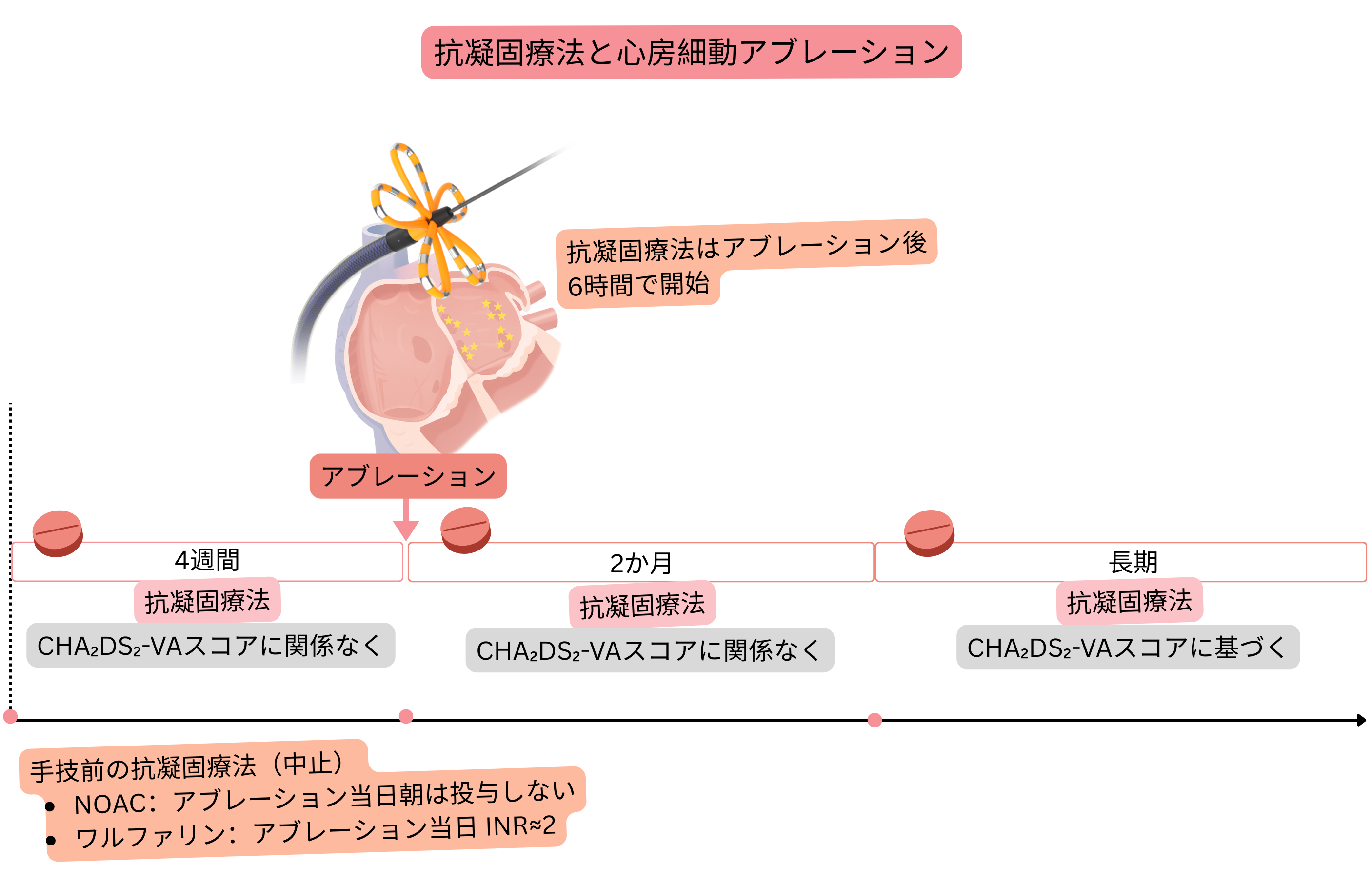心房細動カテーテルアブレーションにおける抗凝固療法管理の模式図で、術前、アブレーション直後、最初の2か月間およびCHA₂DS₂-VAスコアに基づく長期的判断を示している。