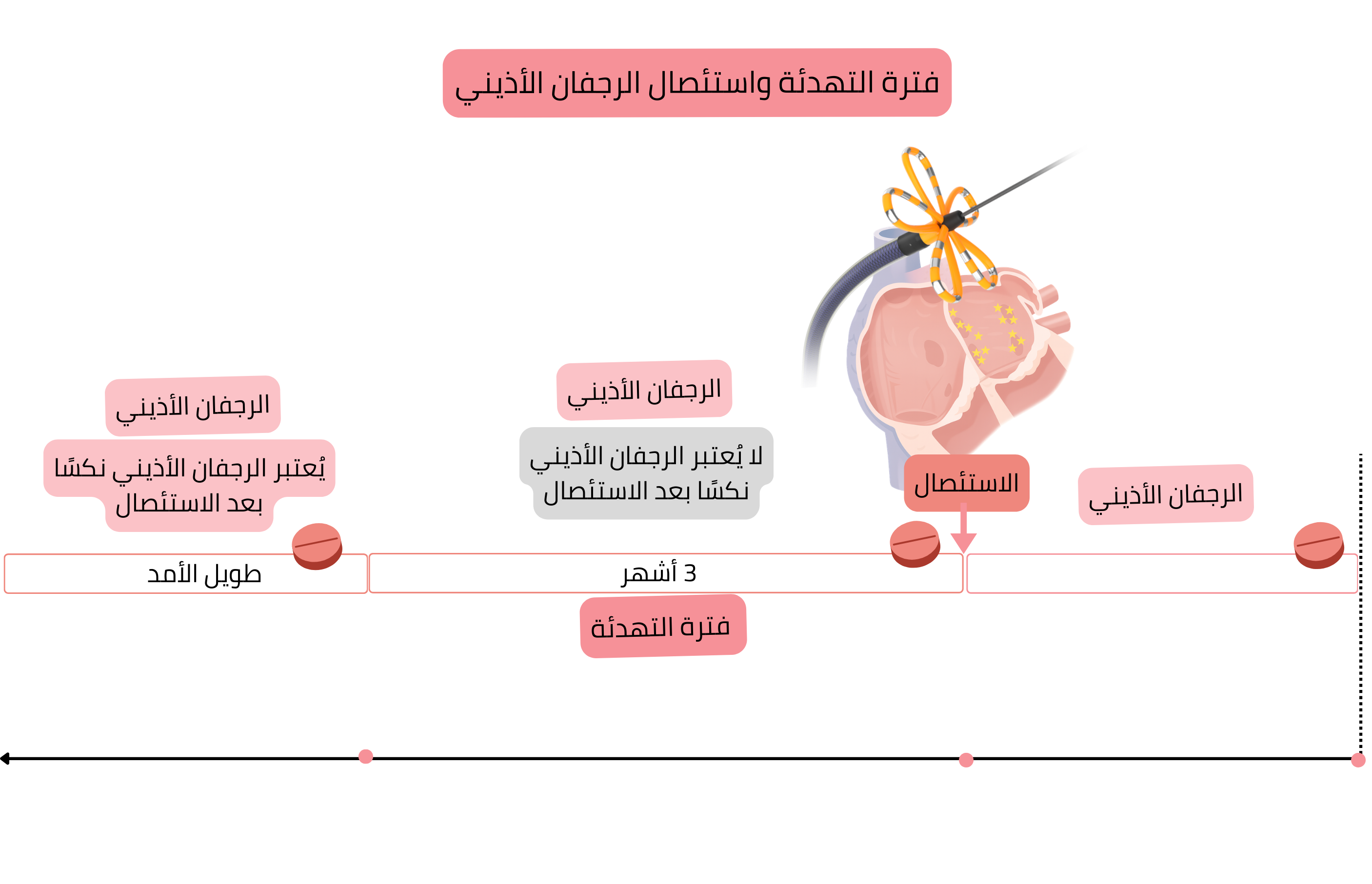 مخطط فترة الـ blanking بعد الاستئصال بالقسطرة للرجفان الأذيني يوضح استراتيجية العلاج بمضادات اضطراب النظم ومضادات التخثر خلال الأشهر الثلاثة الأولى، ثم التدبير طويل الأمد وفق نكس الرجفان الأذيني ونقاط CHA₂DS₂-VASc.