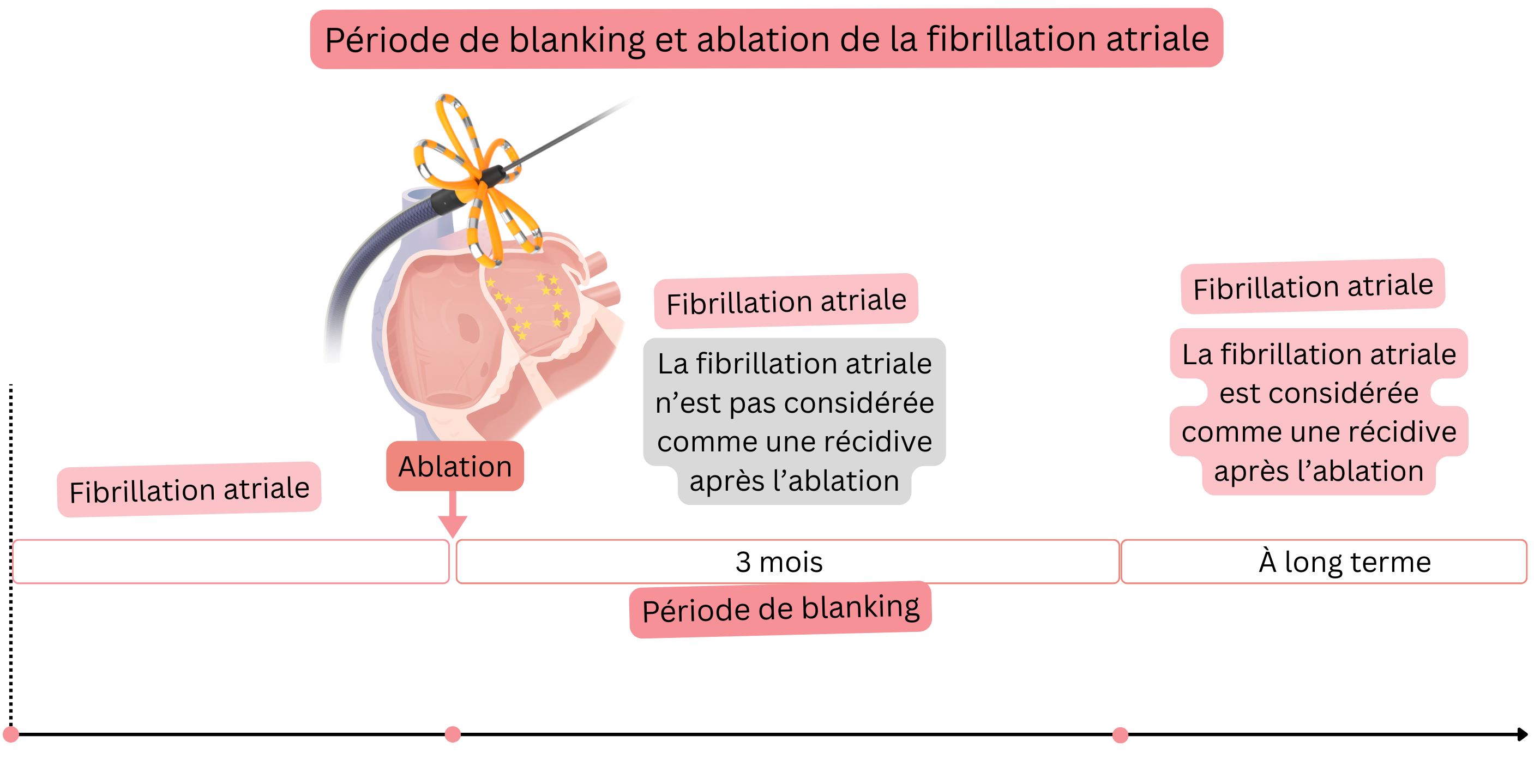 Schéma de la période de blanking après l’ablation par cathéter de la fibrillation auriculaire illustrant la stratégie de traitement antiarythmique et anticoagulant pendant les trois premiers mois et la prise en charge à long terme selon la récidive de la fibrillation auriculaire et le score CHA₂DS₂-VASc.