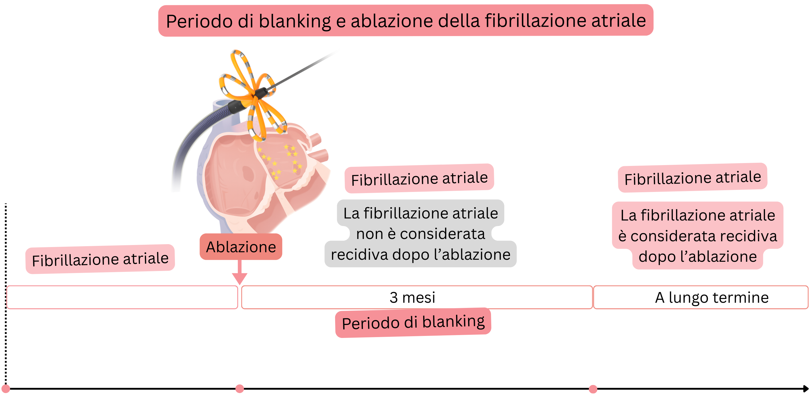 Schema del periodo di blanking dopo ablazione transcatetere della fibrillazione atriale che illustra la strategia di terapia antiaritmica e anticoagulante nei primi tre mesi e la gestione a lungo termine in base alla recidiva della fibrillazione atriale e al punteggio CHA₂DS₂-VASc.