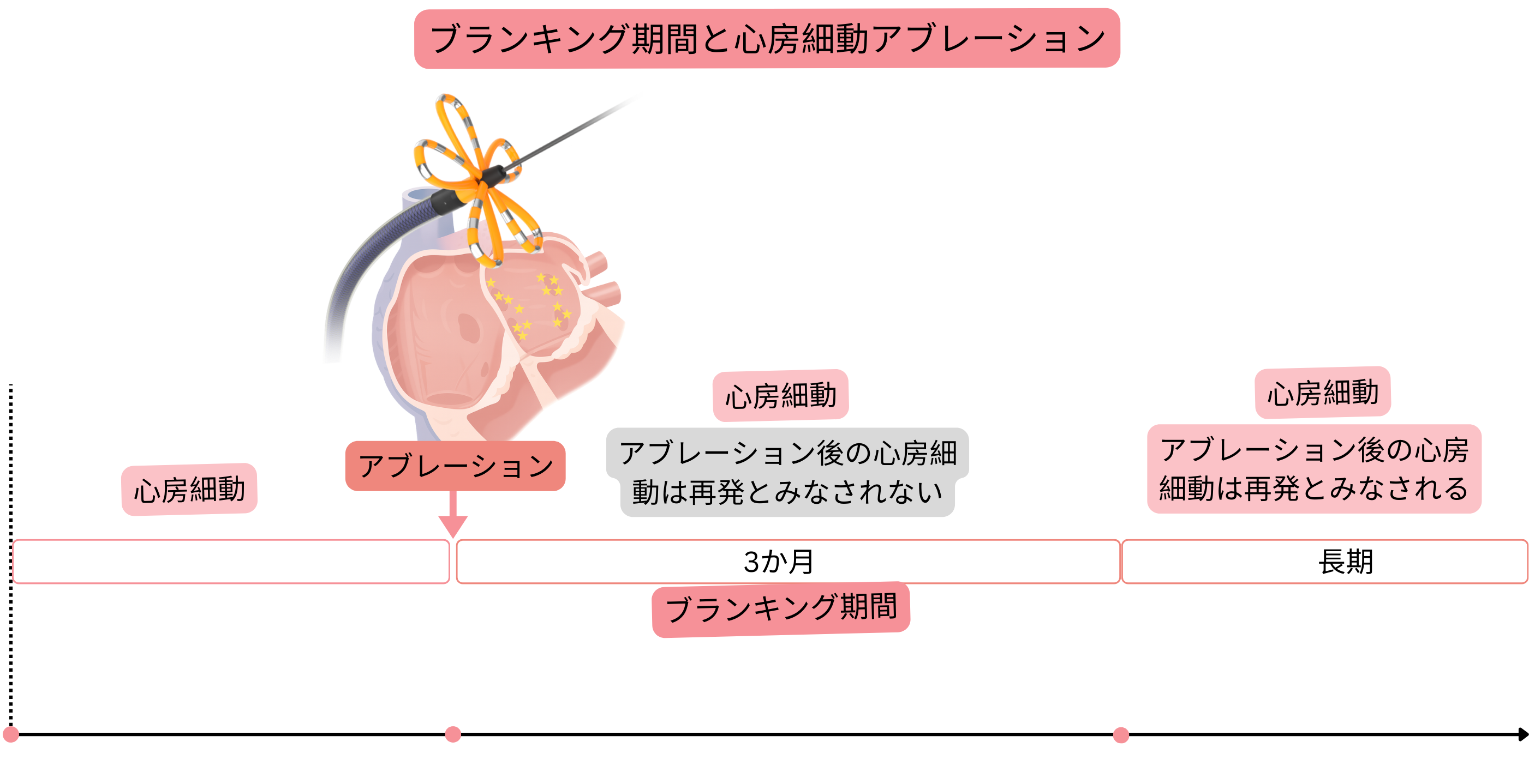 心房細動のカテーテルアブレーション後のブランキング期間を示す模式図で、最初の3か月間の抗不整脈薬および抗凝固療法の戦略と、心房細動再発およびCHA₂DS₂-VAScスコアに基づく長期管理を示す。