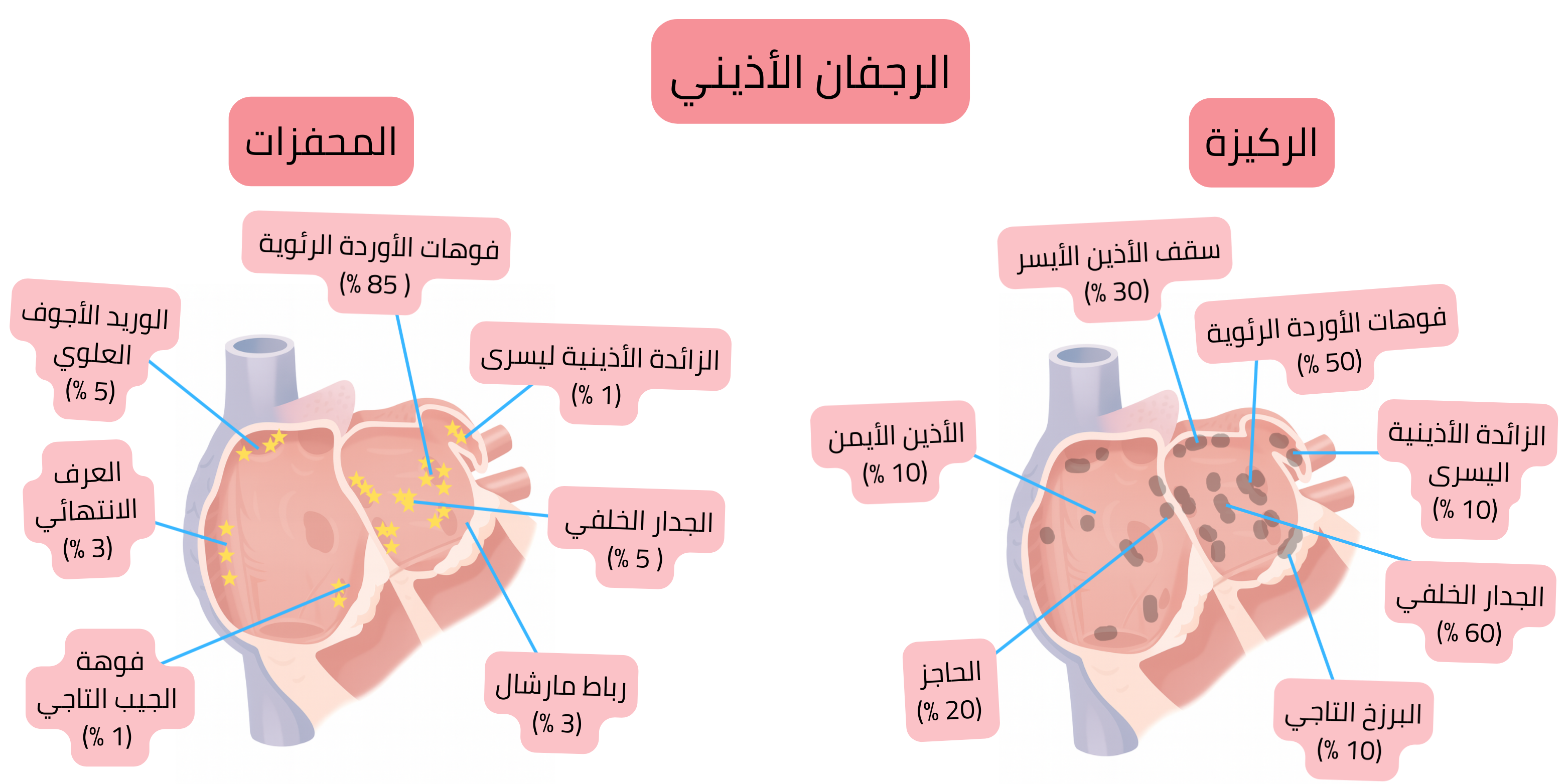 مخطط للرجفان الأذيني يوضح بؤر التحريض والركيزة الأذينية، بما في ذلك فوهات الأوردة الرئوية والجدار الخلفي ومناطق تشريحية أخرى.