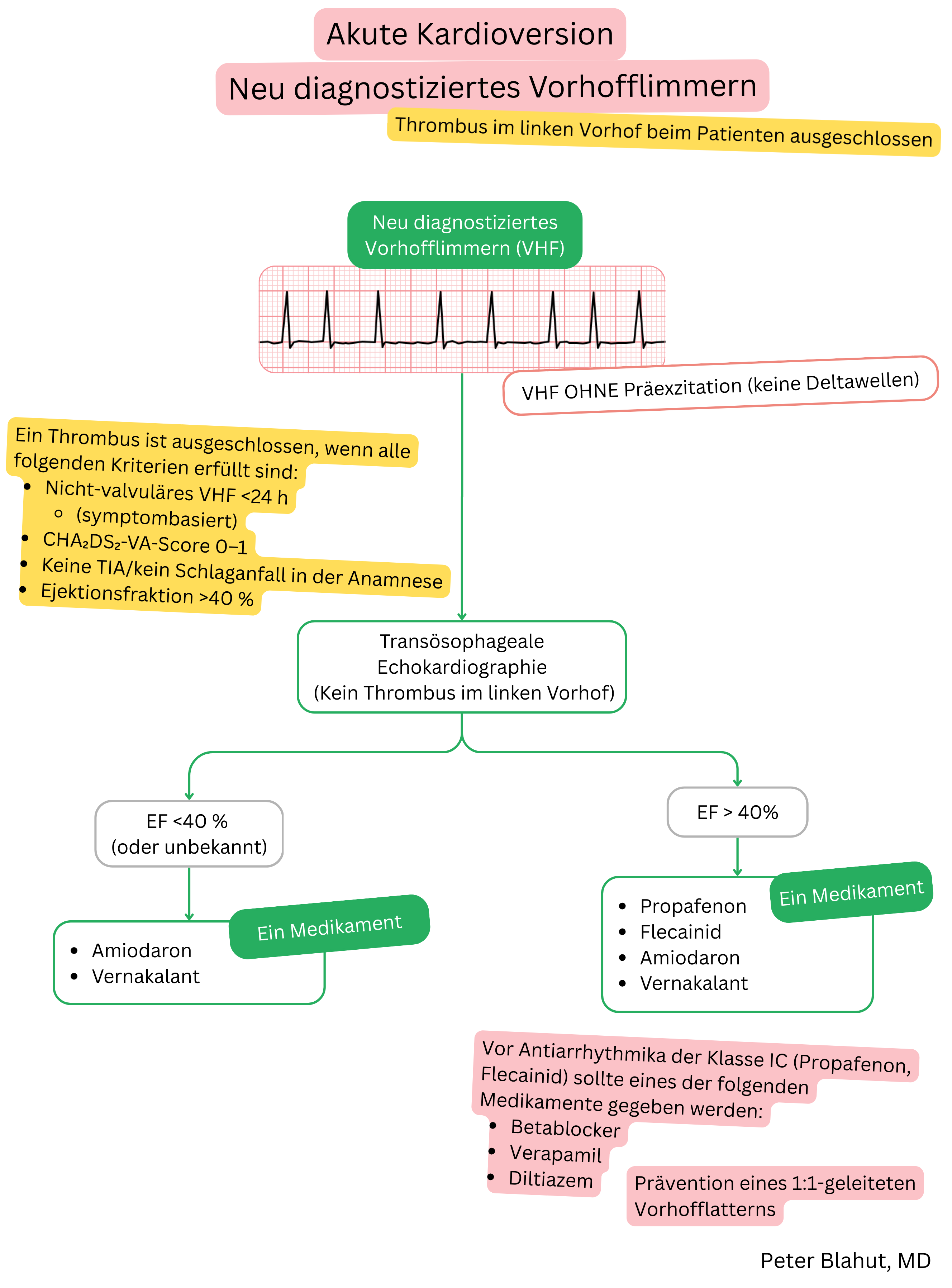 Leitlinienalgorithmus zur akuten Kardioversion bei neu diagnostiziertem Vorhofflimmern ohne Präexzitation mit Auswahl von Antiarrhythmika nach linksventrikulärer Ejektionsfraktion.